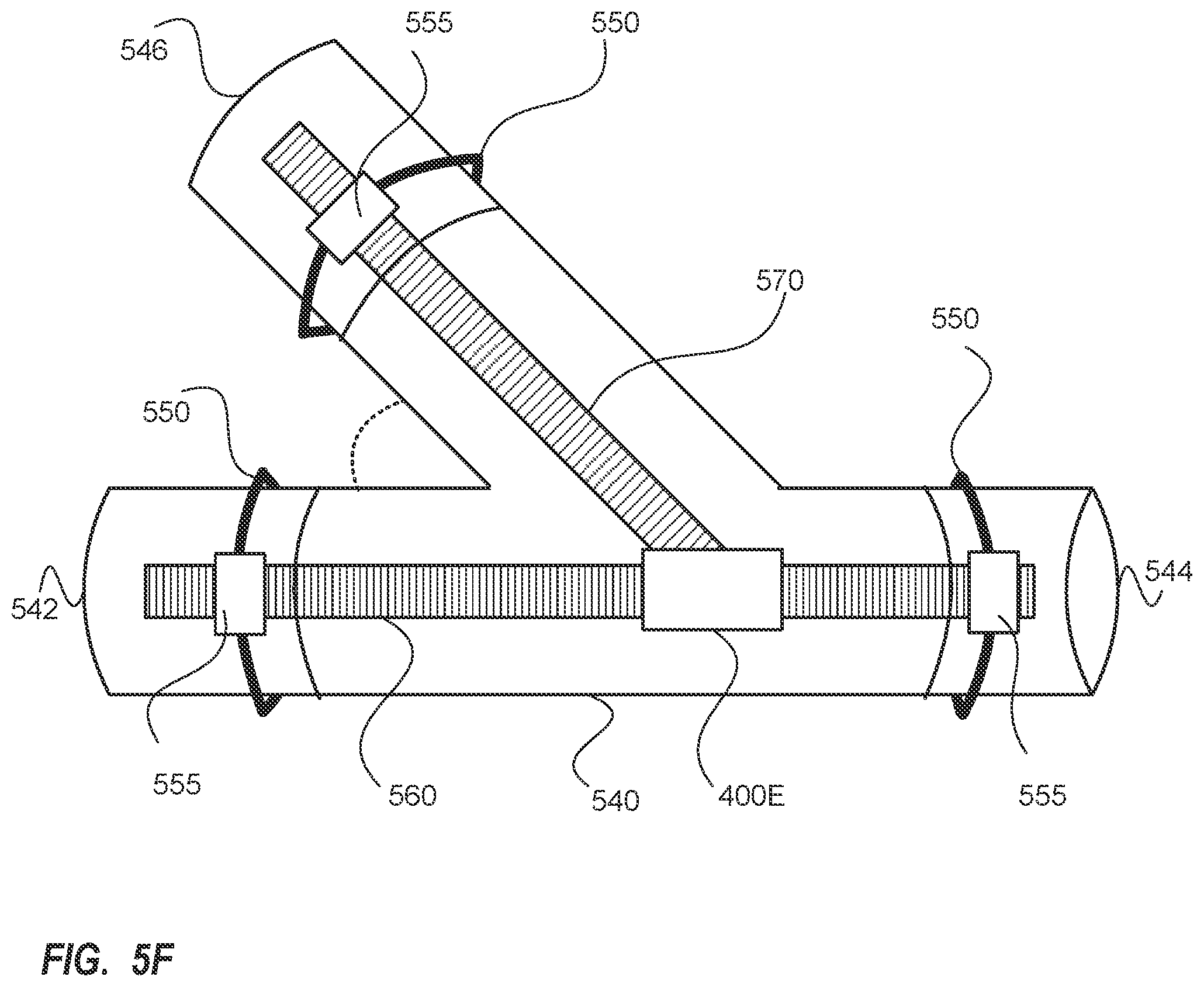 Patent US12098743 Figure 8 – Angled threaded rod coupling having mountable pass-through coupler and improvements thereof
