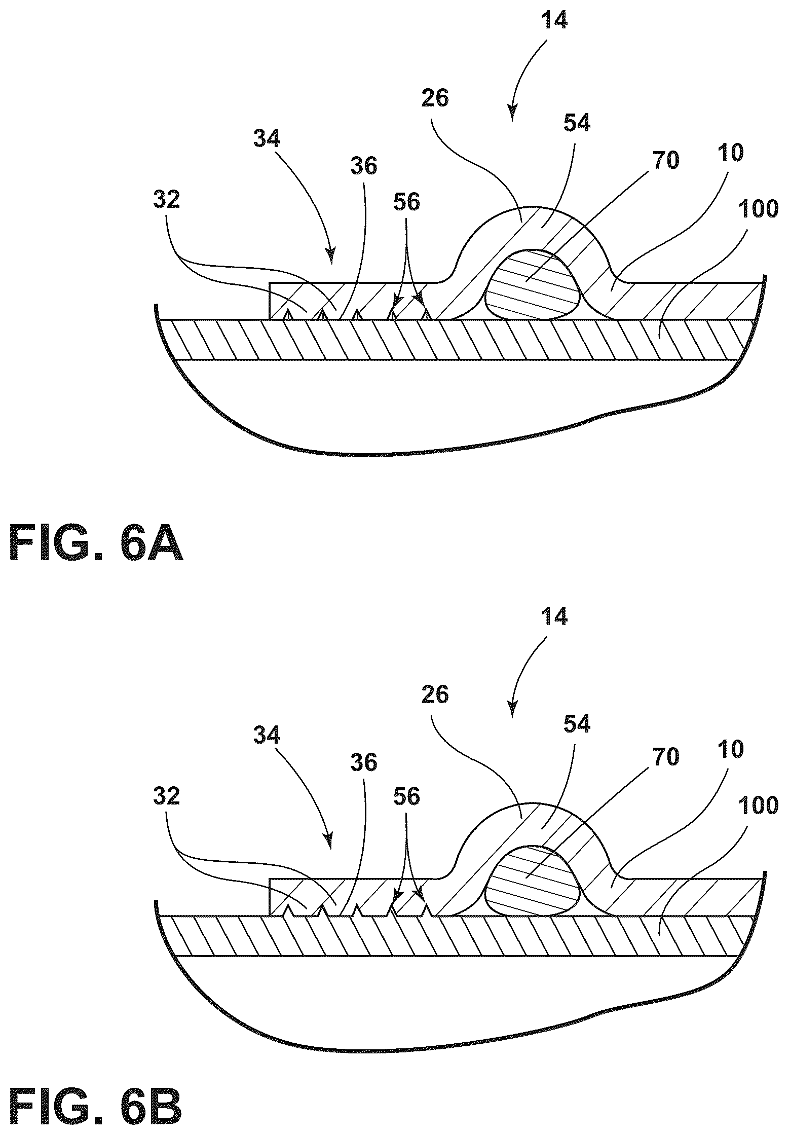 Patent US12098784 Figure 4 – Piping component having a plurality of grooves