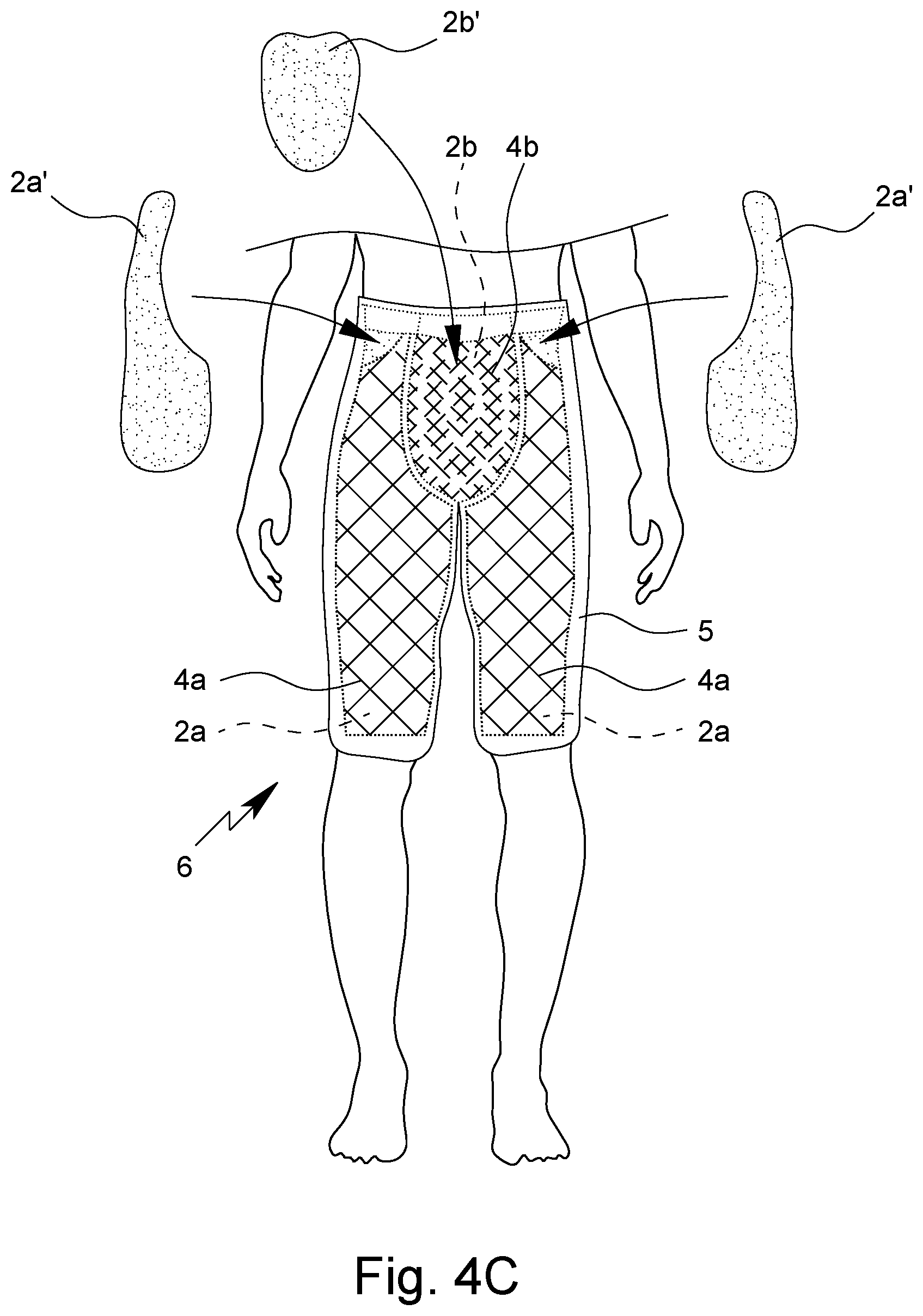 Patent US12098906 Figure 5 – Protective clothing unit having preferably textile fragment protection equipment