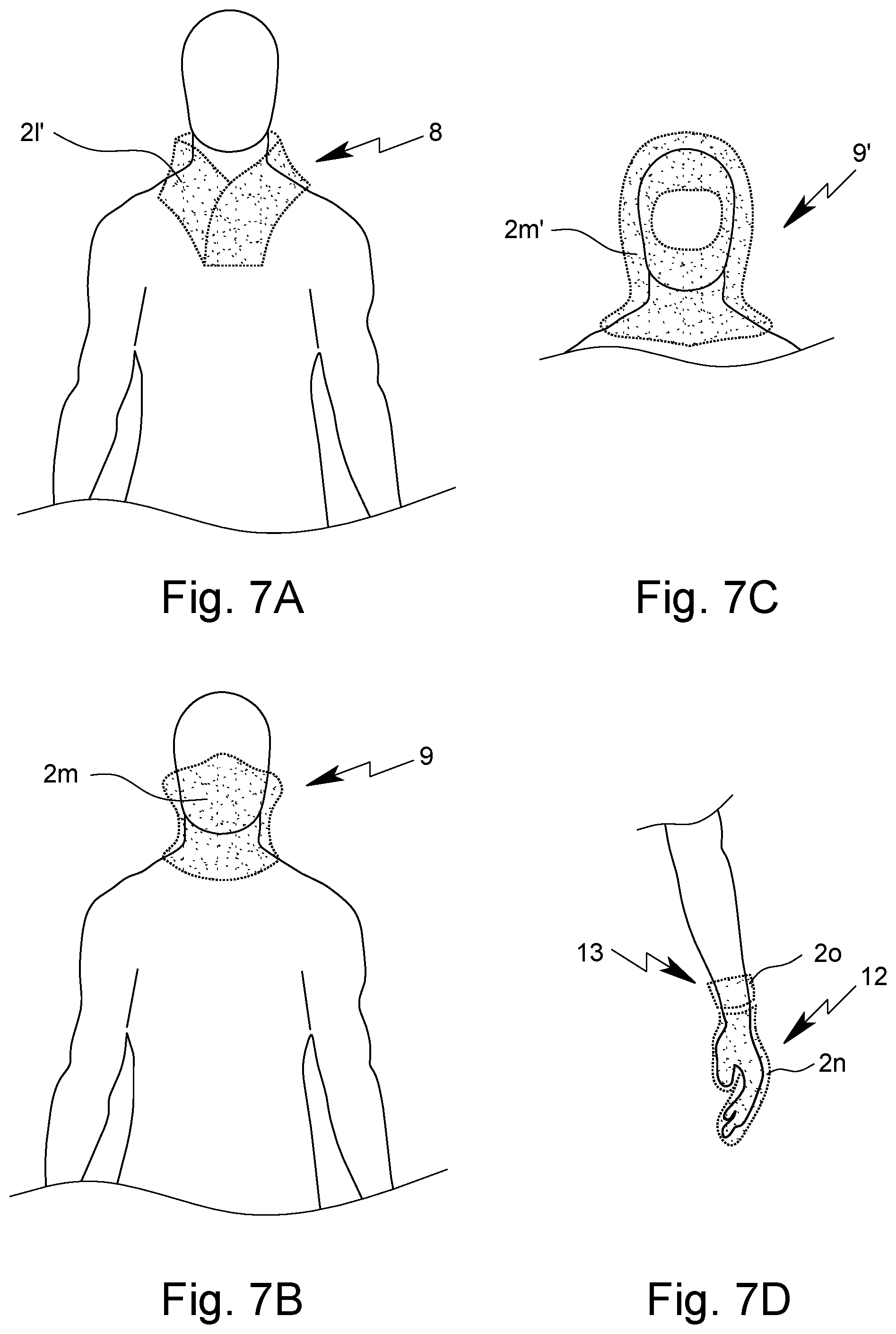 Patent US12098906 Figure 8 – Protective clothing unit having preferably textile fragment protection equipment