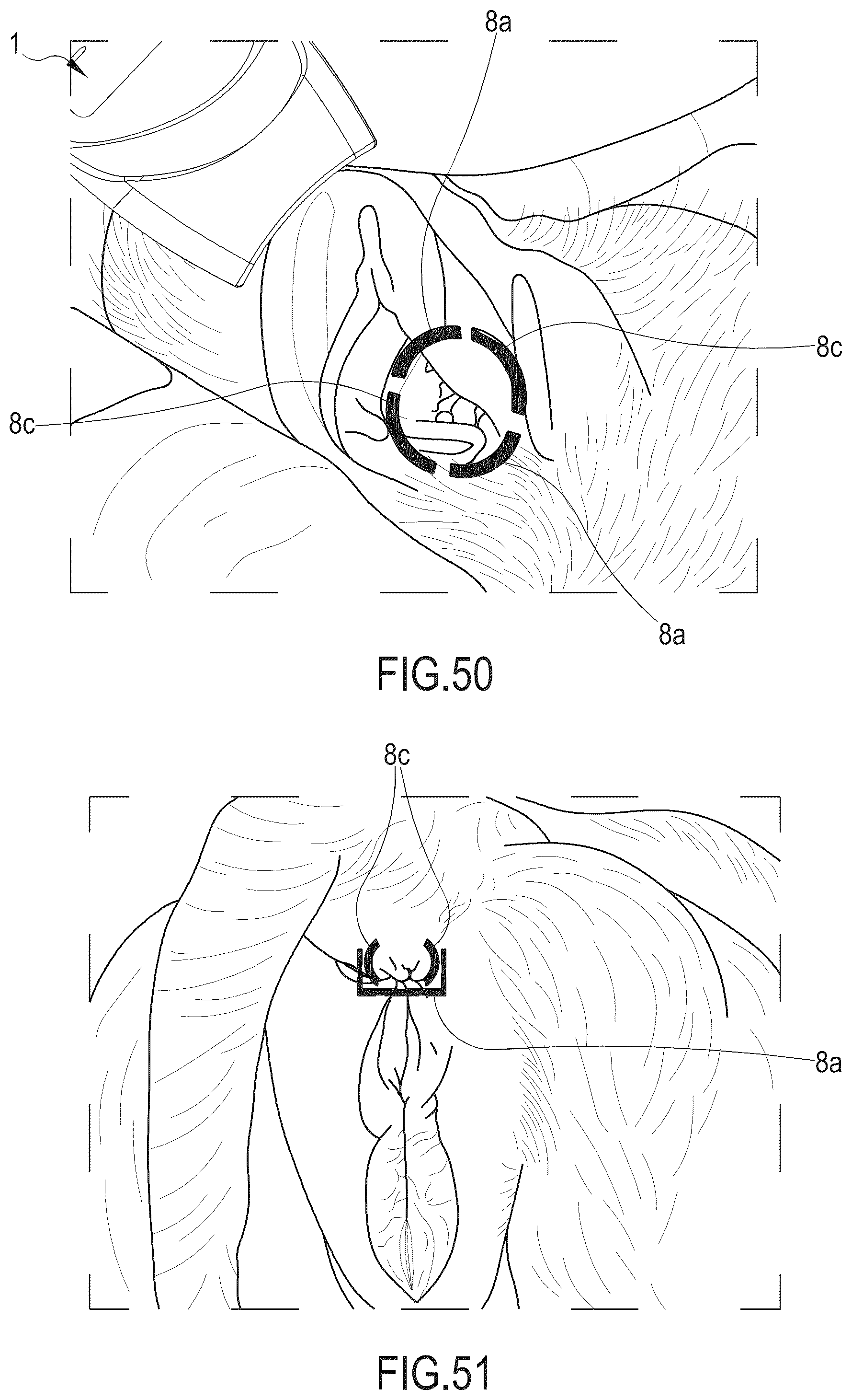 Patent US12098961 Figure 13 – Non-contact infrared thermometer