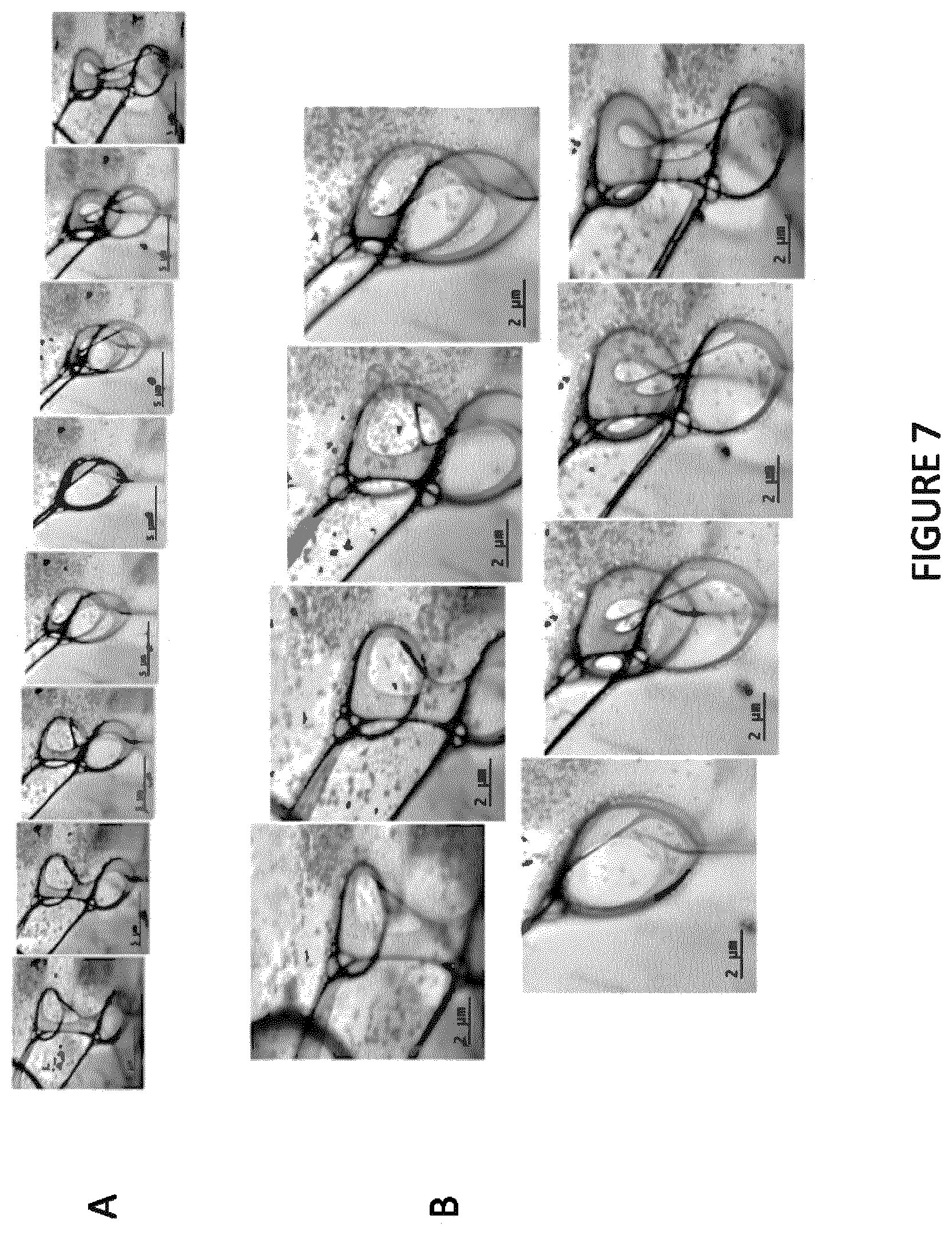 Patent US12099022 Figure 7 – Devices and methods for high angle liquid electron tomography
