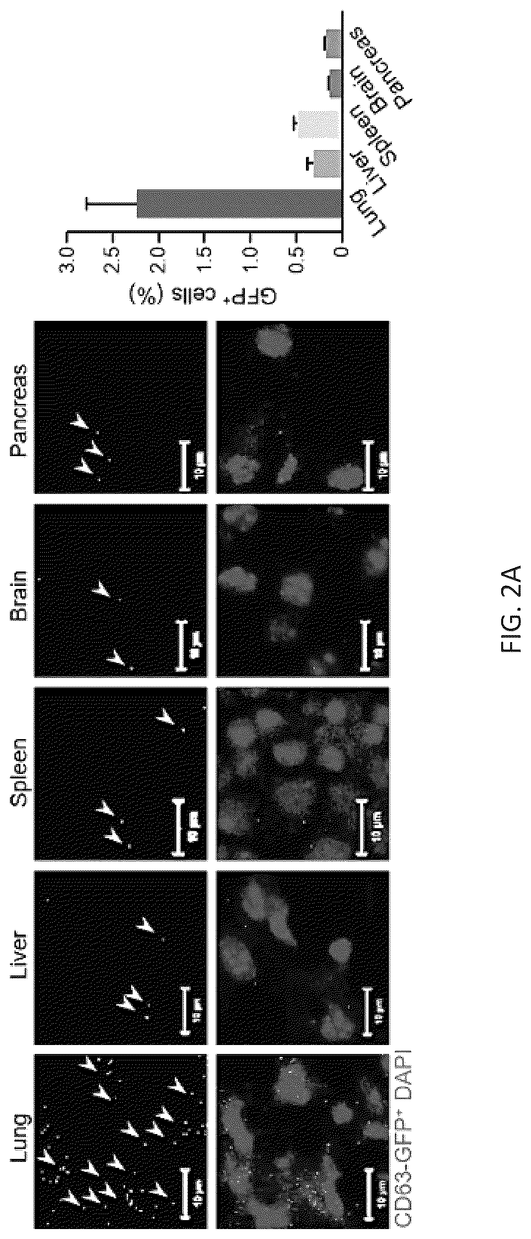 Patent US12099061 Figure 4 – Nidogen 1 as a diagnostic marker and therapeutic target of hepatocellular carcinoma, composition and methods thereof