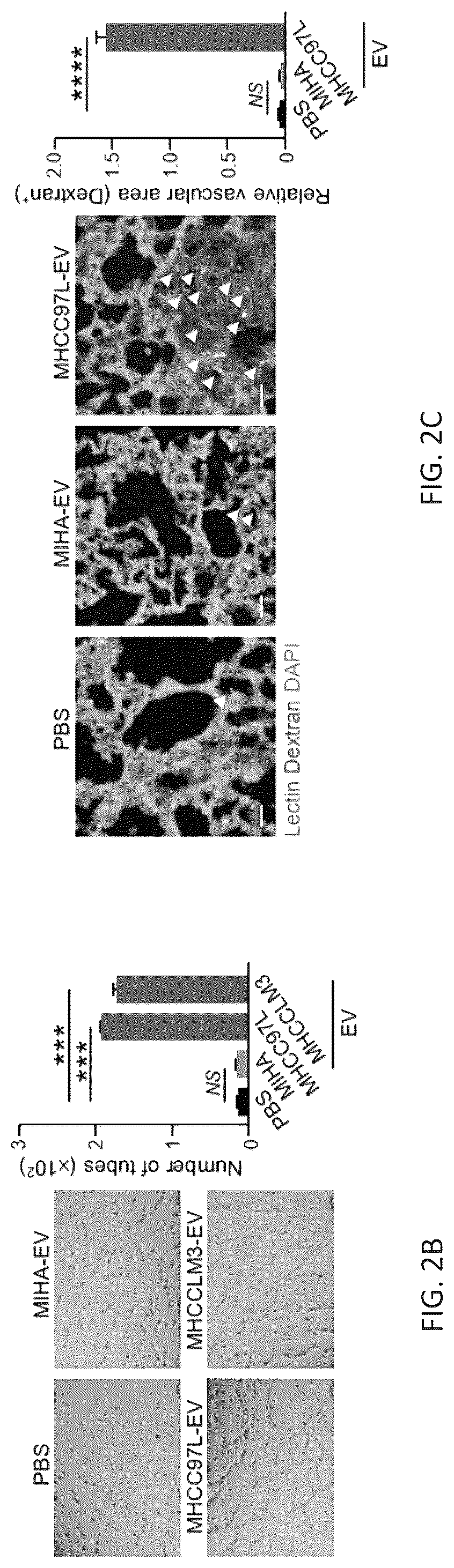 Patent US12099061 Figure 5 – Nidogen 1 as a diagnostic marker and therapeutic target of hepatocellular carcinoma, composition and methods thereof