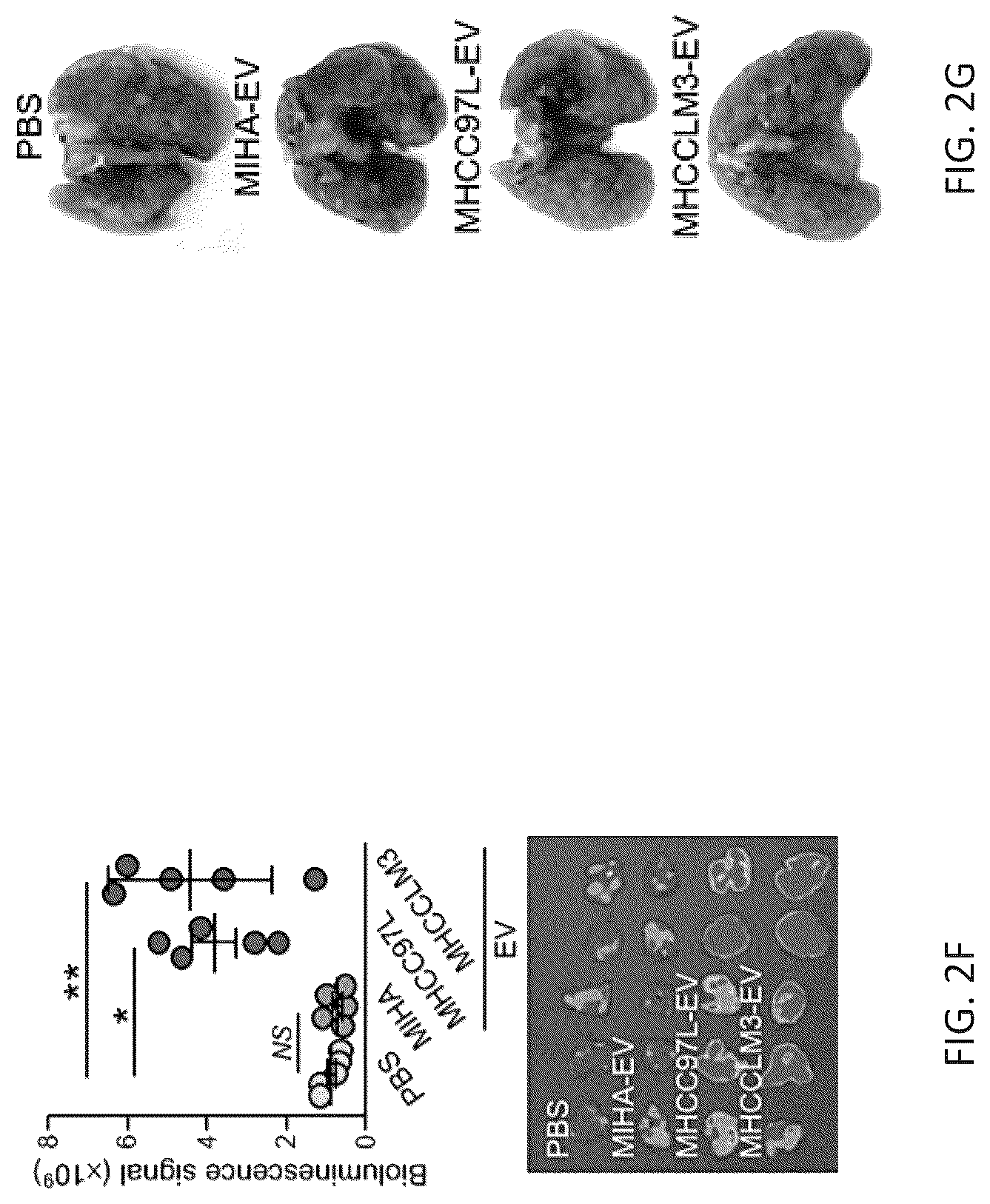 Patent US12099061 Figure 7 – Nidogen 1 as a diagnostic marker and therapeutic target of hepatocellular carcinoma, composition and methods thereof
