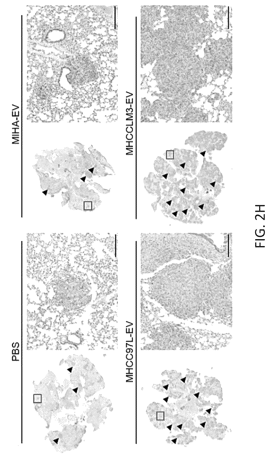Patent US12099061 Figure 8 – Nidogen 1 as a diagnostic marker and therapeutic target of hepatocellular carcinoma, composition and methods thereof