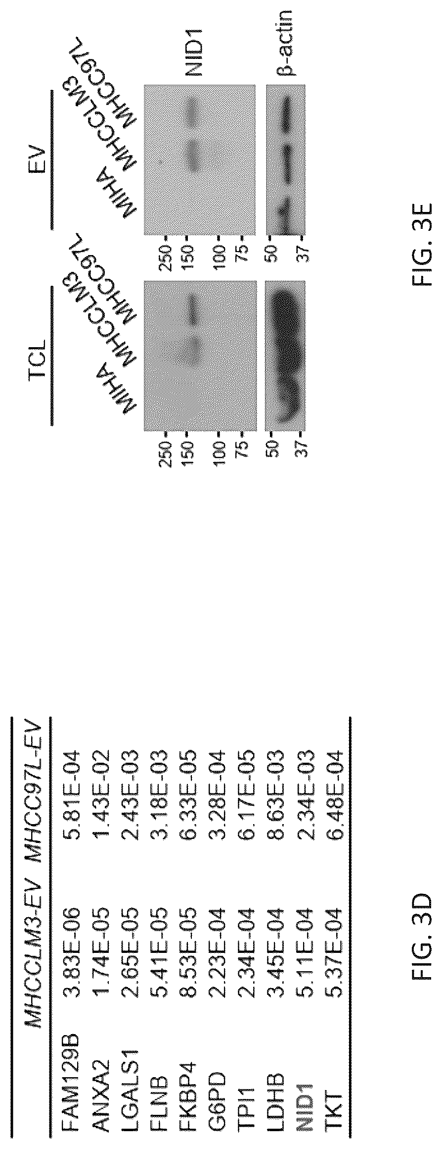 Patent US12099061 Figure 11 – Nidogen 1 as a diagnostic marker and therapeutic target of hepatocellular carcinoma, composition and methods thereof