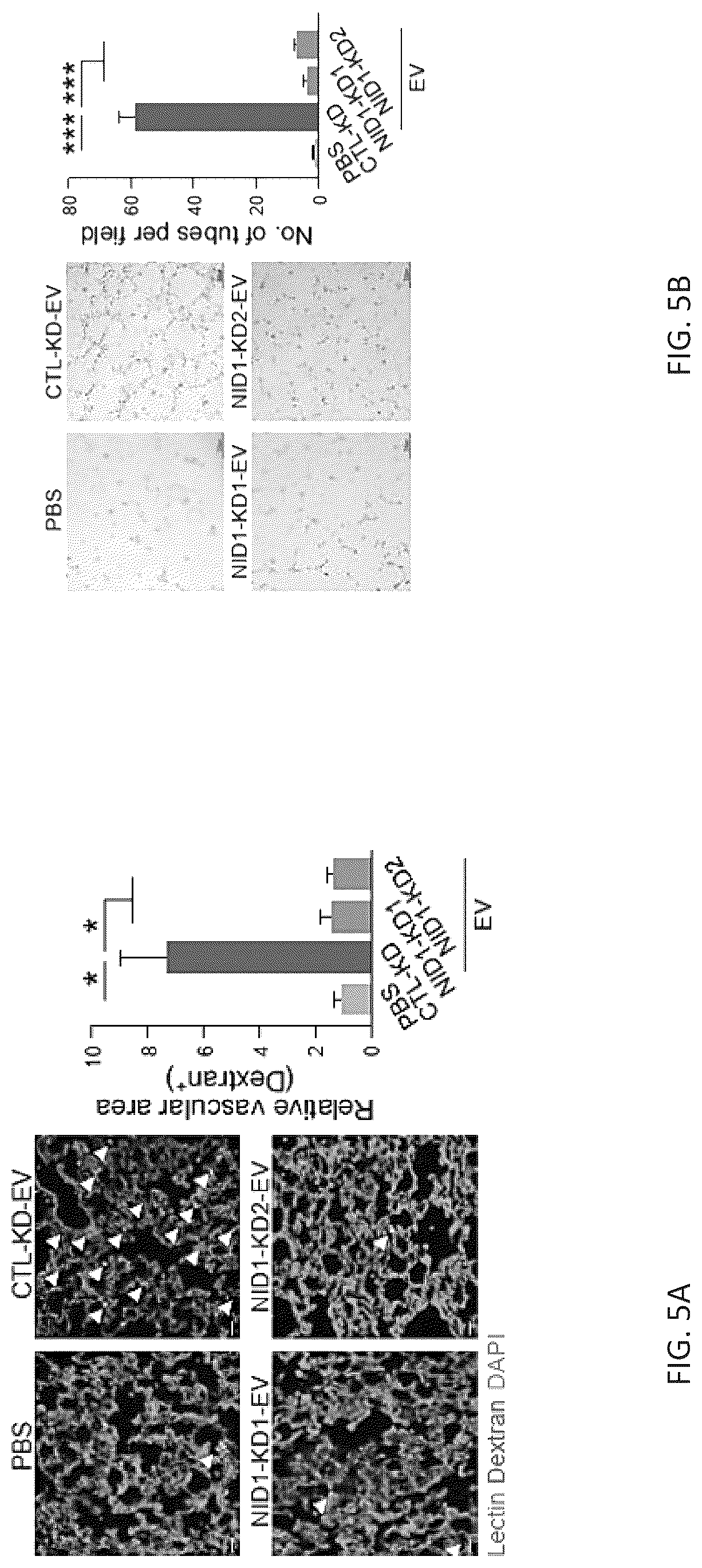 Patent US12099061 Figure 17 – Nidogen 1 as a diagnostic marker and therapeutic target of hepatocellular carcinoma, composition and methods thereof