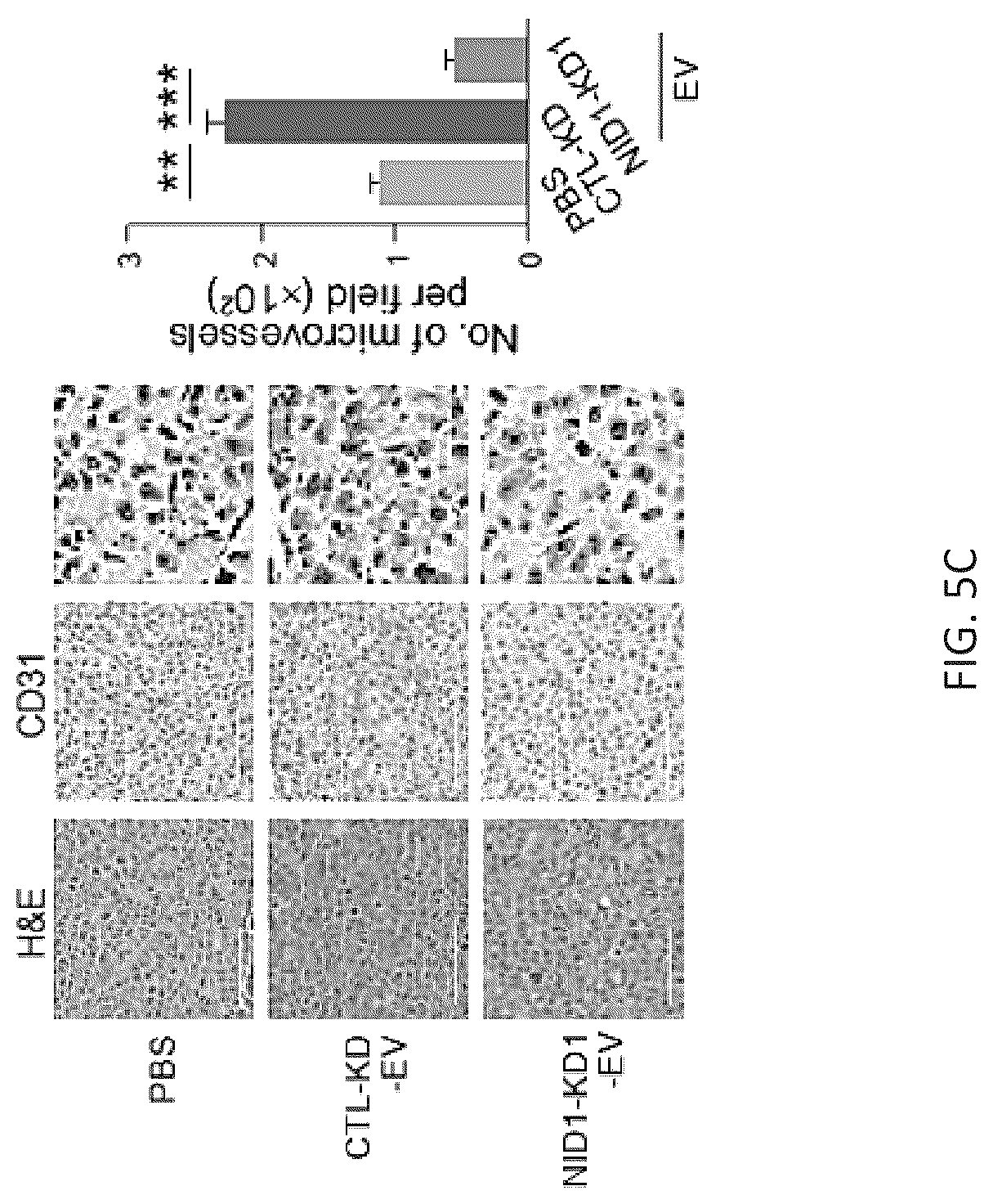Patent US12099061 Figure 18 – Nidogen 1 as a diagnostic marker and therapeutic target of hepatocellular carcinoma, composition and methods thereof