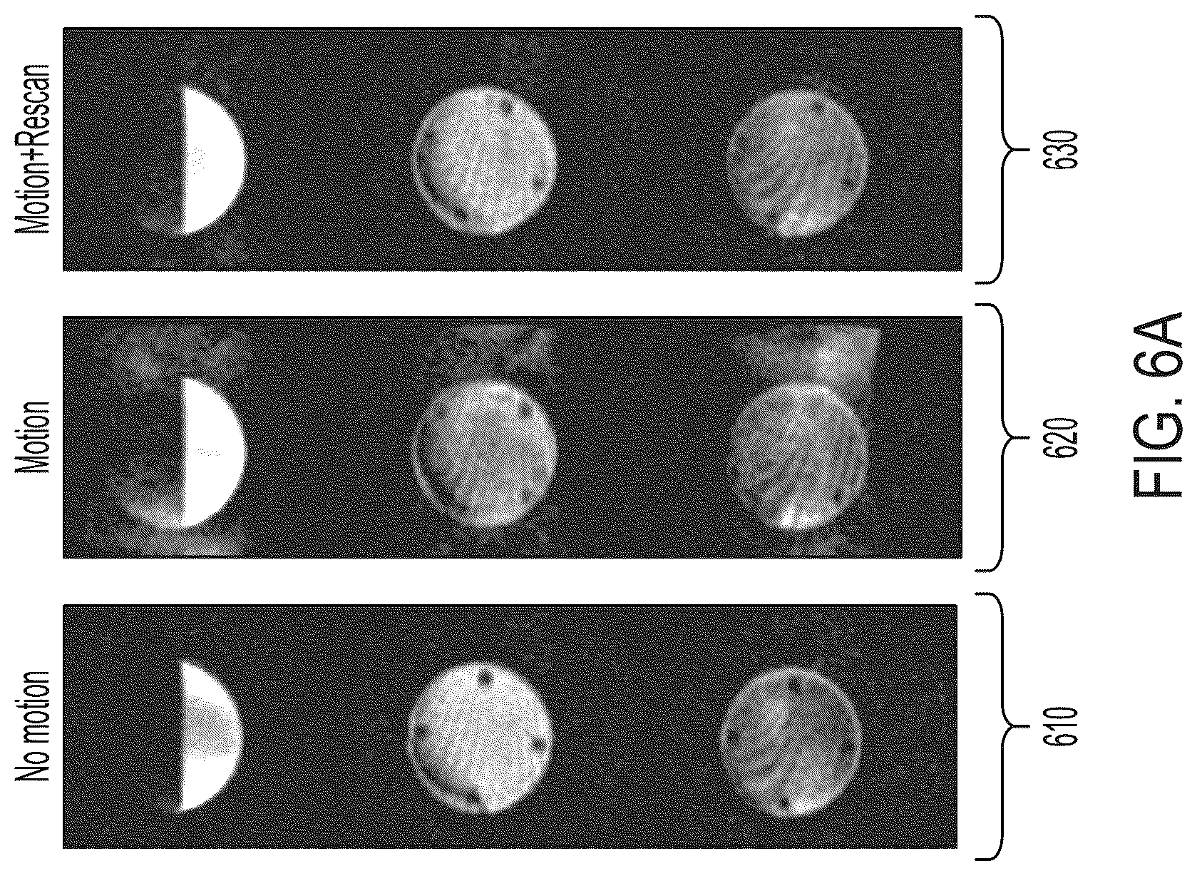 Patent US12099105 Figure 11 – Systems and methods for dynamically extending magnetic resonance imaging of a subject