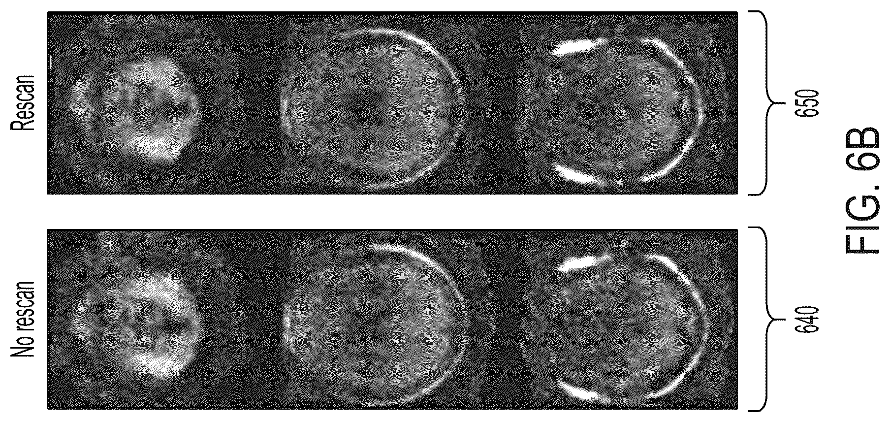 Patent US12099105 Figure 12 – Systems and methods for dynamically extending magnetic resonance imaging of a subject