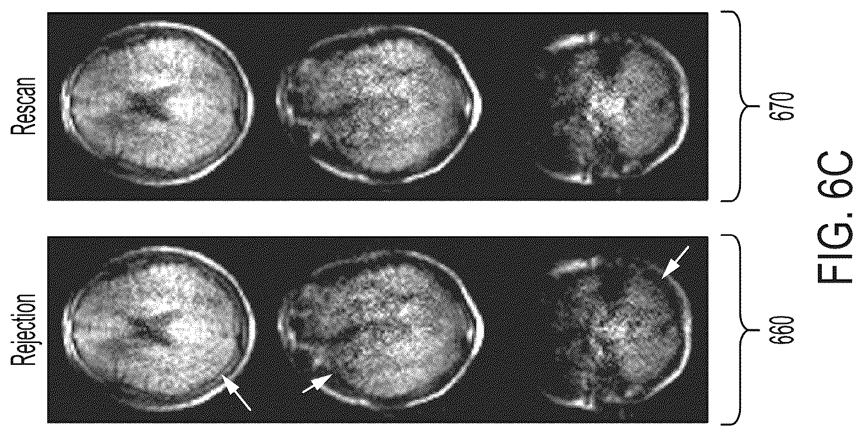 Patent US12099105 Figure 13 – Systems and methods for dynamically extending magnetic resonance imaging of a subject