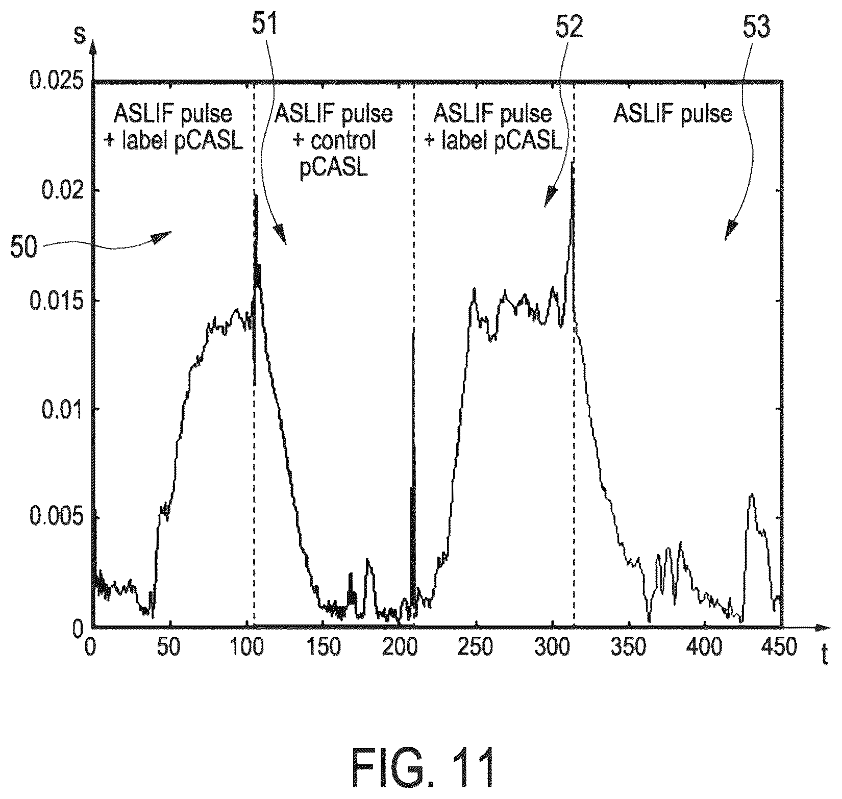 Patent US12099106 Figure 11 – Arterial spin labeling with evaluation of inversion state of magnetization