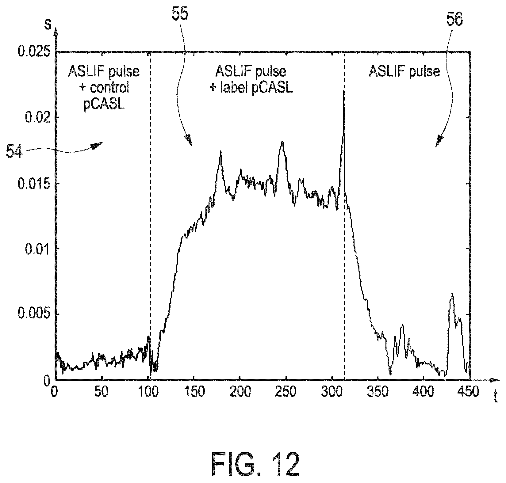 Patent US12099106 Figure 12 – Arterial spin labeling with evaluation of inversion state of magnetization