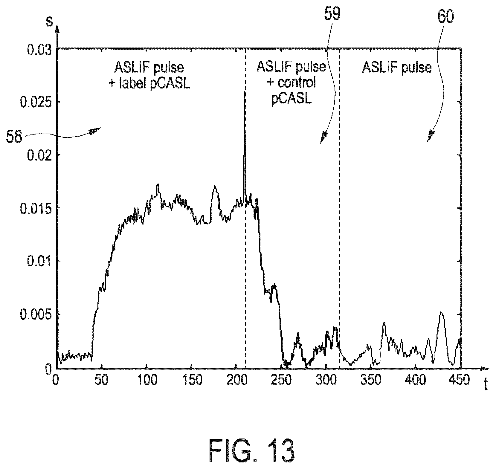 Patent US12099106 Figure 13 – Arterial spin labeling with evaluation of inversion state of magnetization