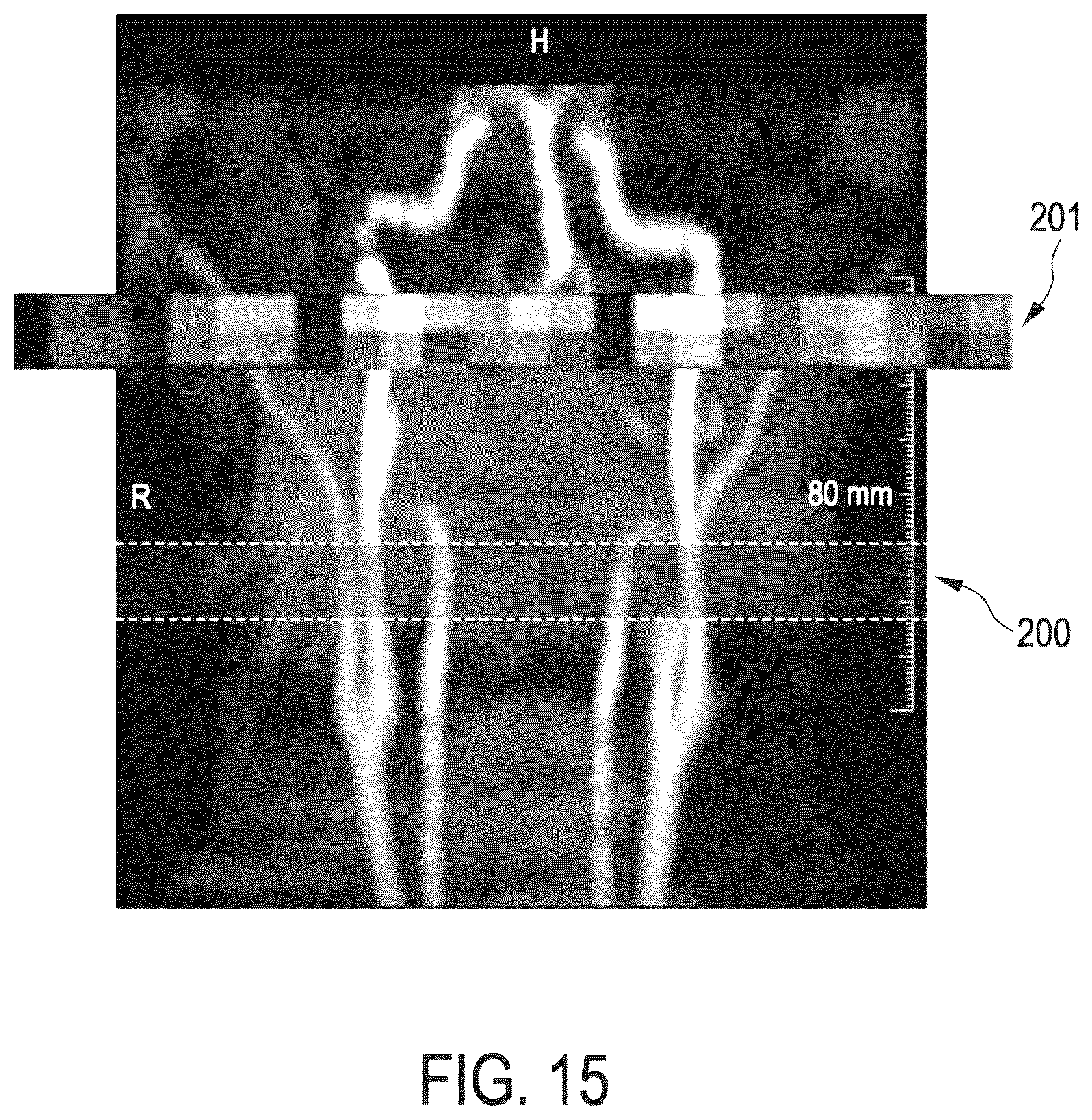 Patent US12099106 Figure 15 – Arterial spin labeling with evaluation of inversion state of magnetization