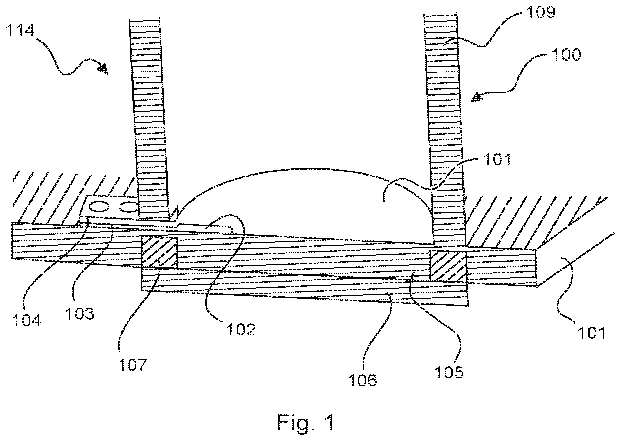 Patent US12099137 Figure 1 – Radar module comprising a microwave chip
