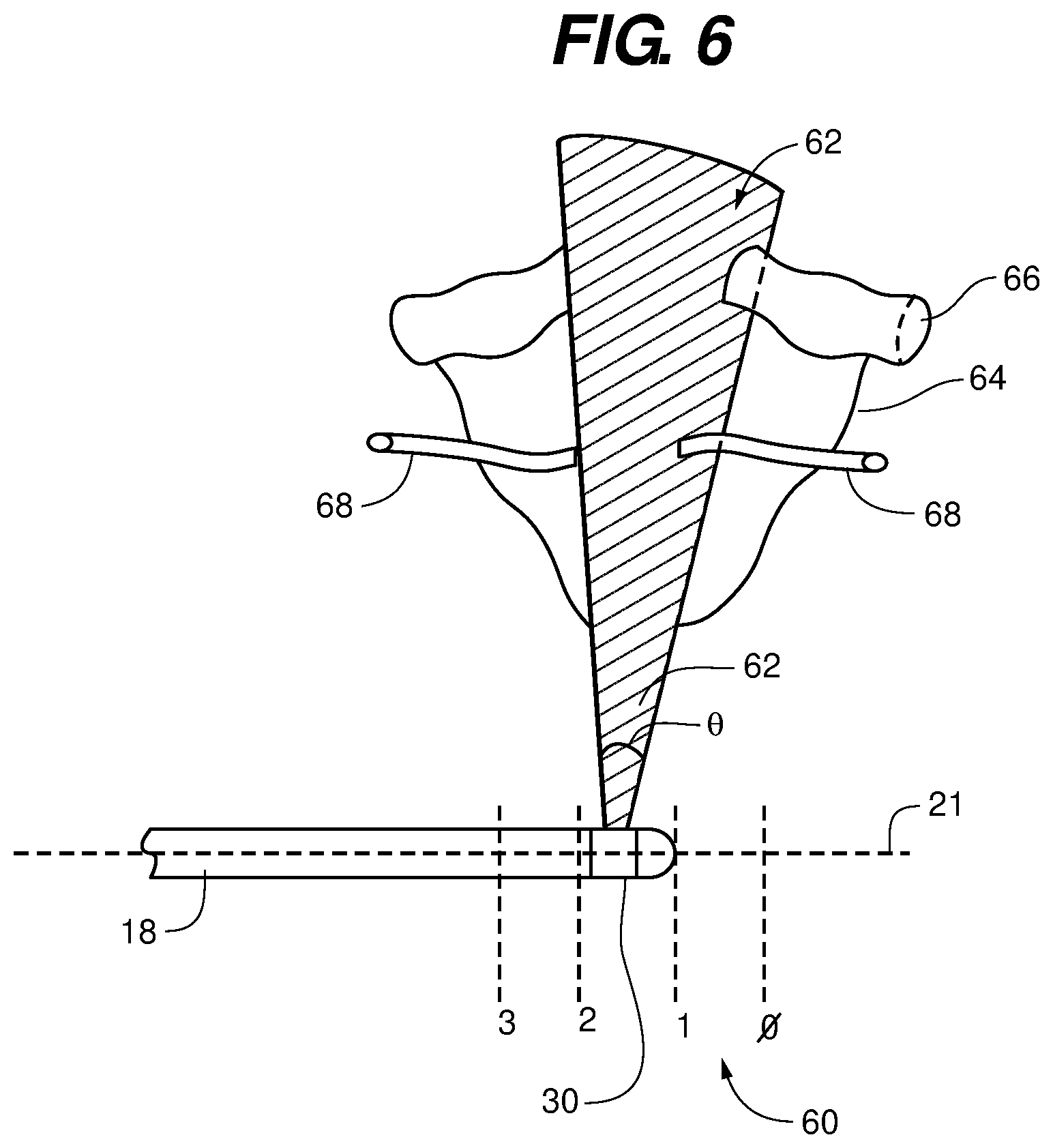 Patent US12099149 Figure 5 – Endobronchial catheter system and method for rapid diagnosis of lung disease
