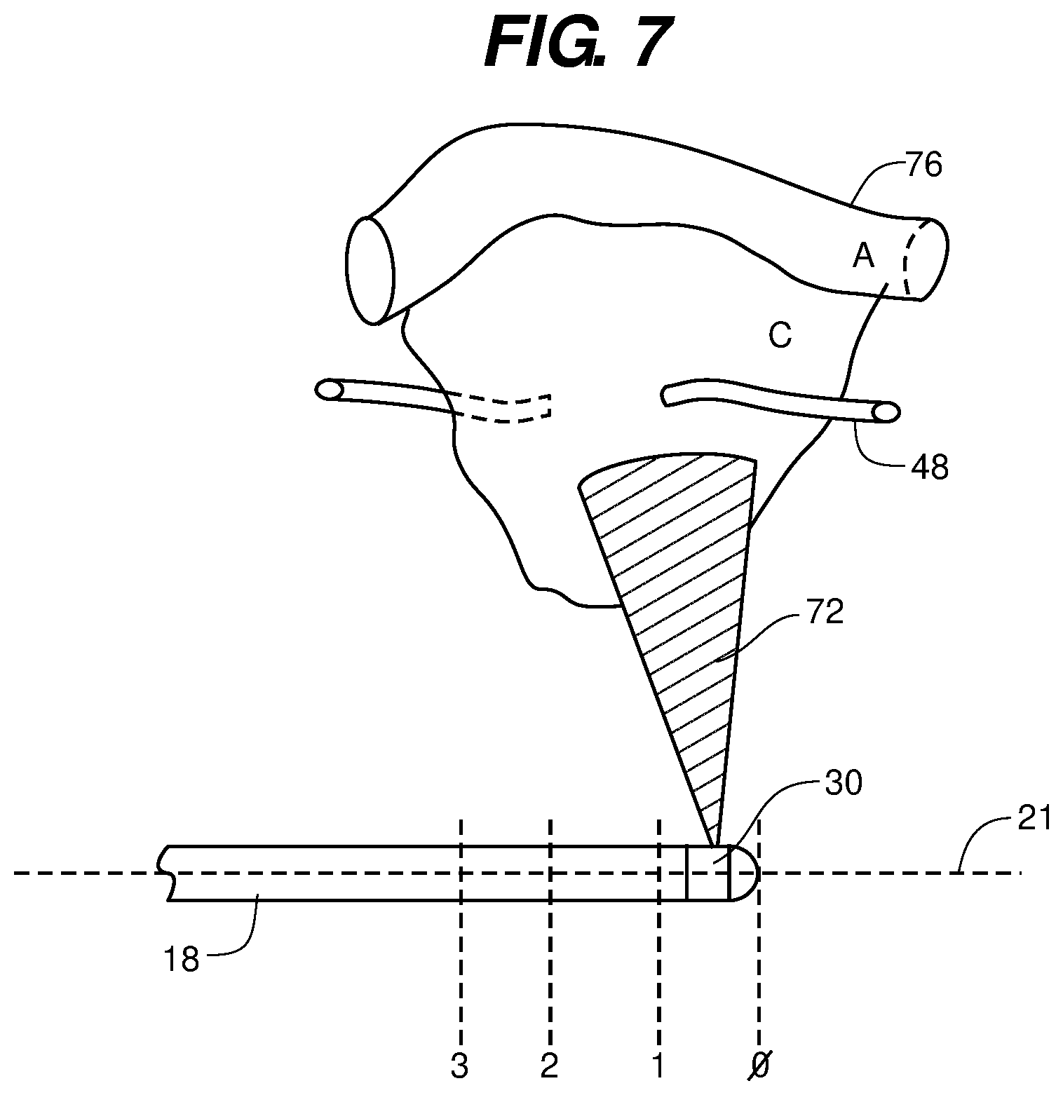 Patent US12099149 Figure 6 – Endobronchial catheter system and method for rapid diagnosis of lung disease