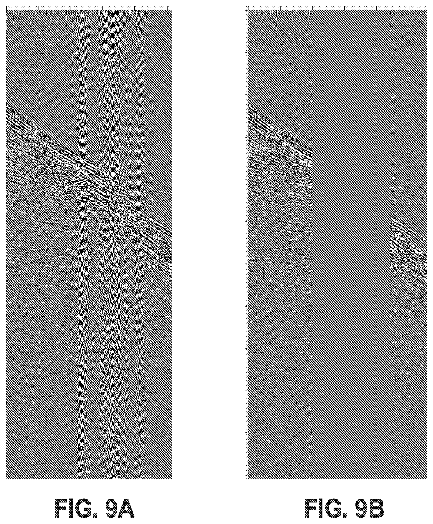 Patent US12099156 Figure 10 – Combining noise attenuation and wavefield reconstruction in seismic processing
