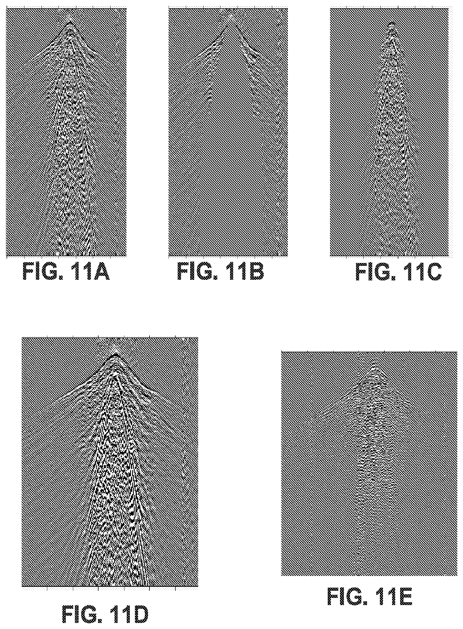 Patent US12099156 Figure 11 – Combining noise attenuation and wavefield reconstruction in seismic processing