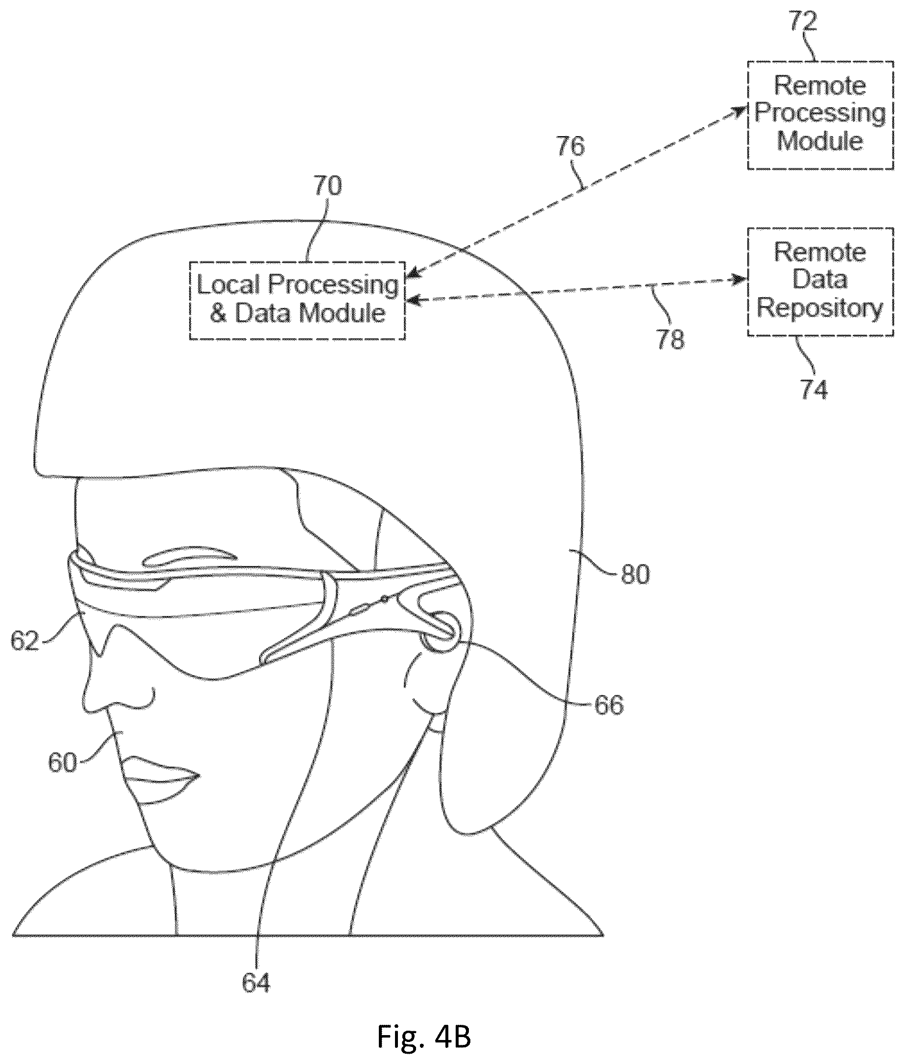 Patent US12099193 Figure 4 – Virtual and augmented reality systems and methods having improved diffractive grating structures