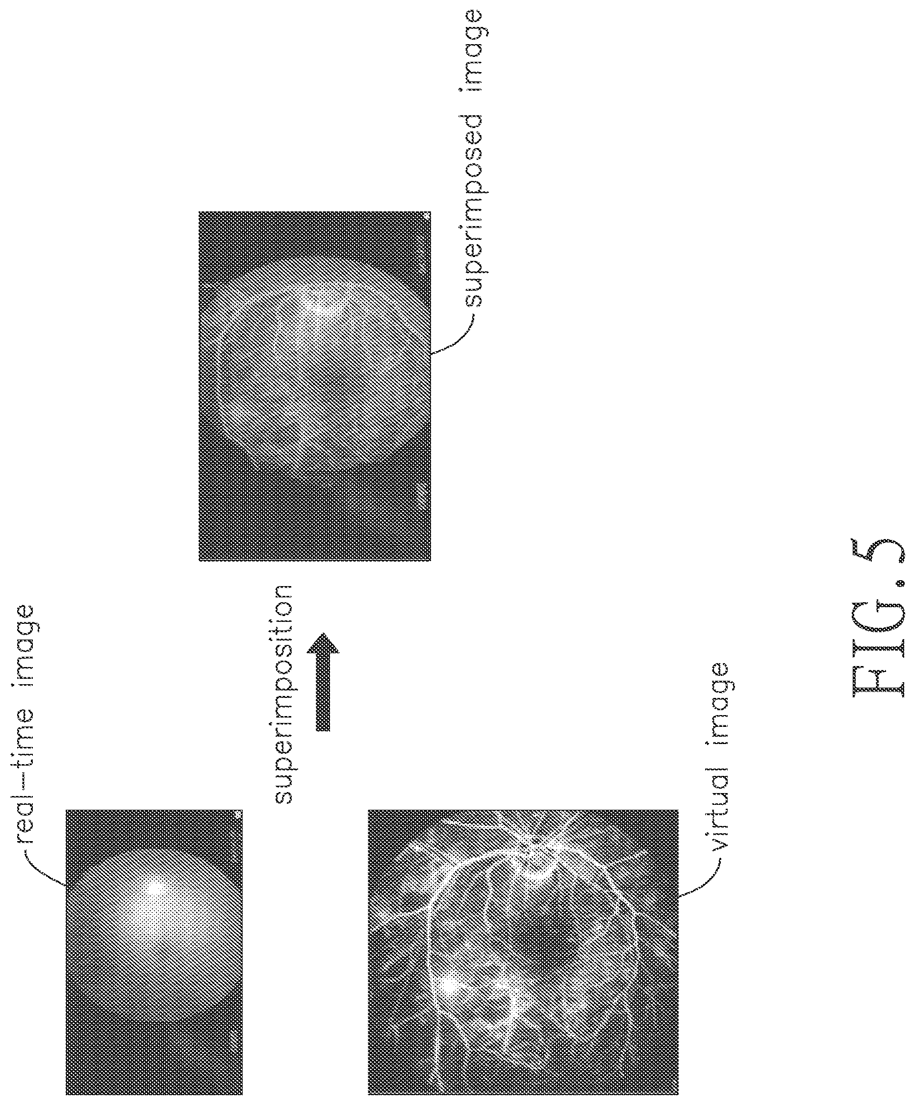 Patent US12099200 Figure 8 – Head wearable virtual image module for superimposing virtual image on real-time image