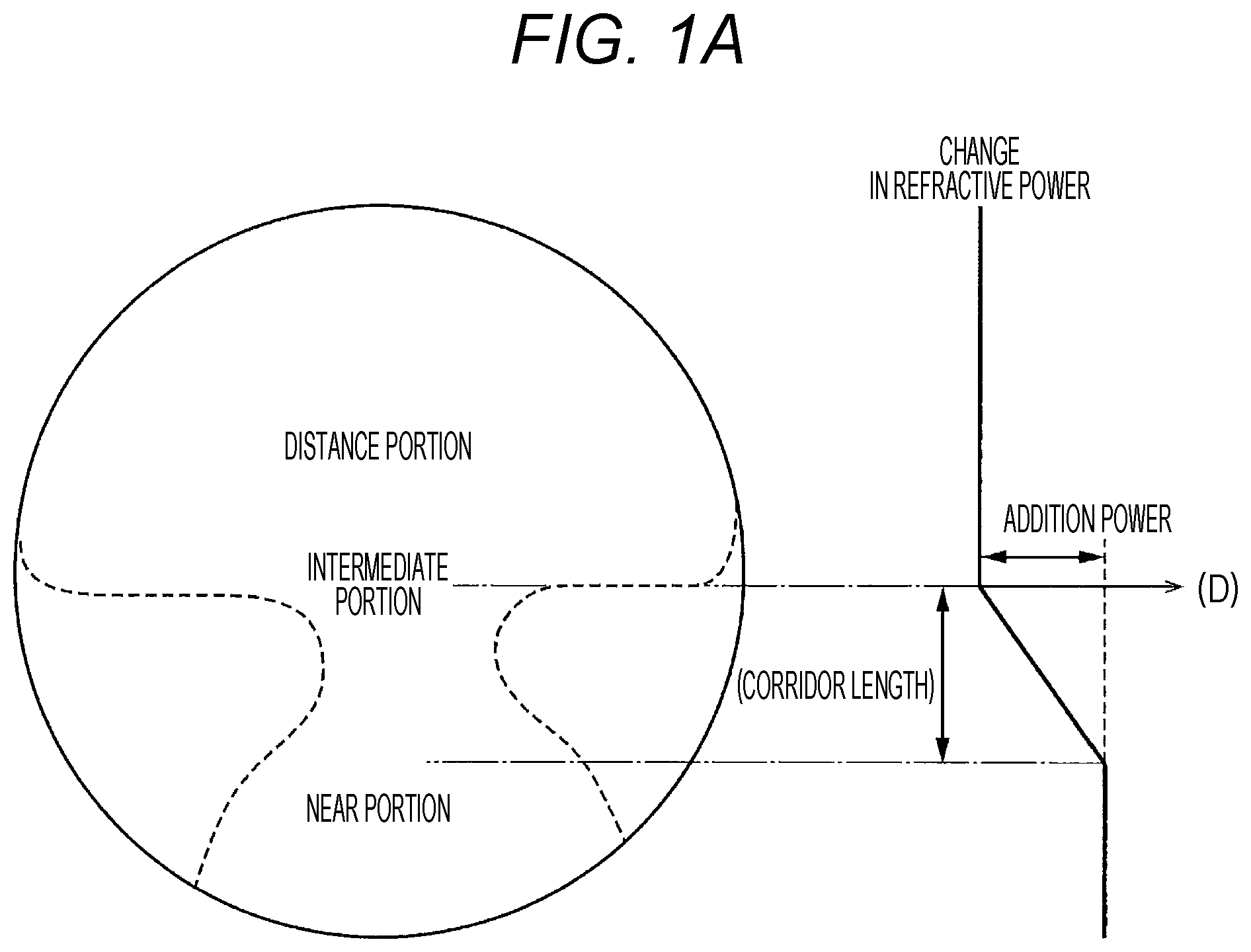 Patent US12099260 Figure 1 – Progressive addition lens and design method therefor