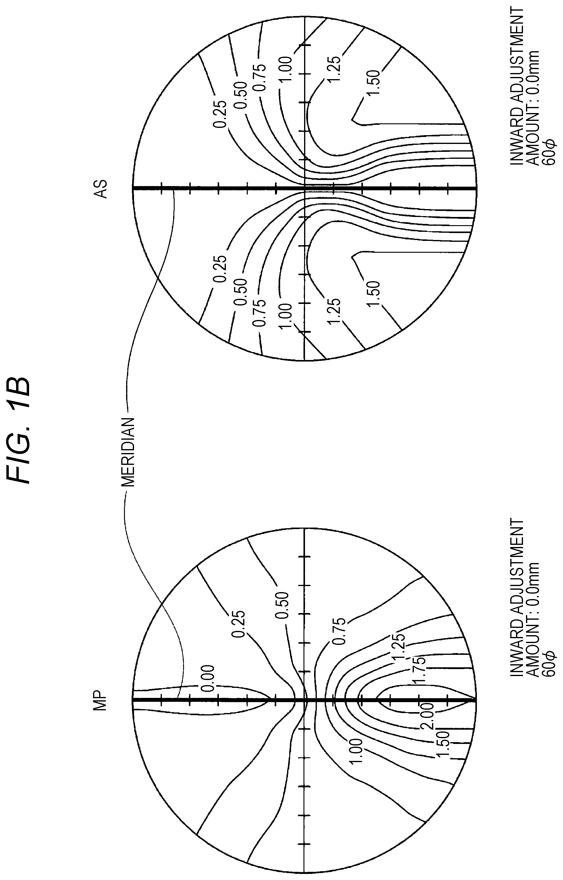 Patent US12099260 Figure 2 – Progressive addition lens and design method therefor