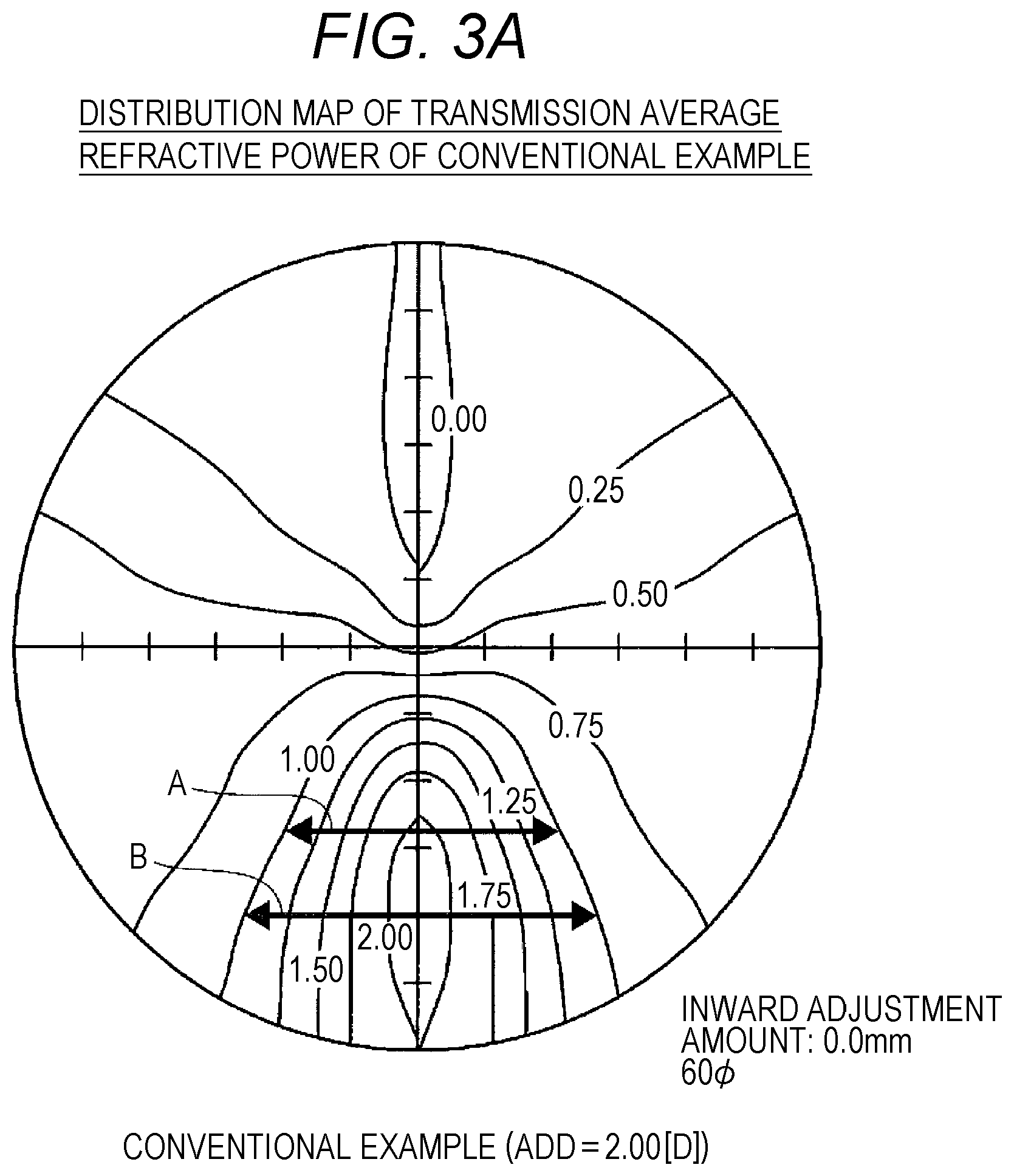 Patent US12099260 Figure 4 – Progressive addition lens and design method therefor
