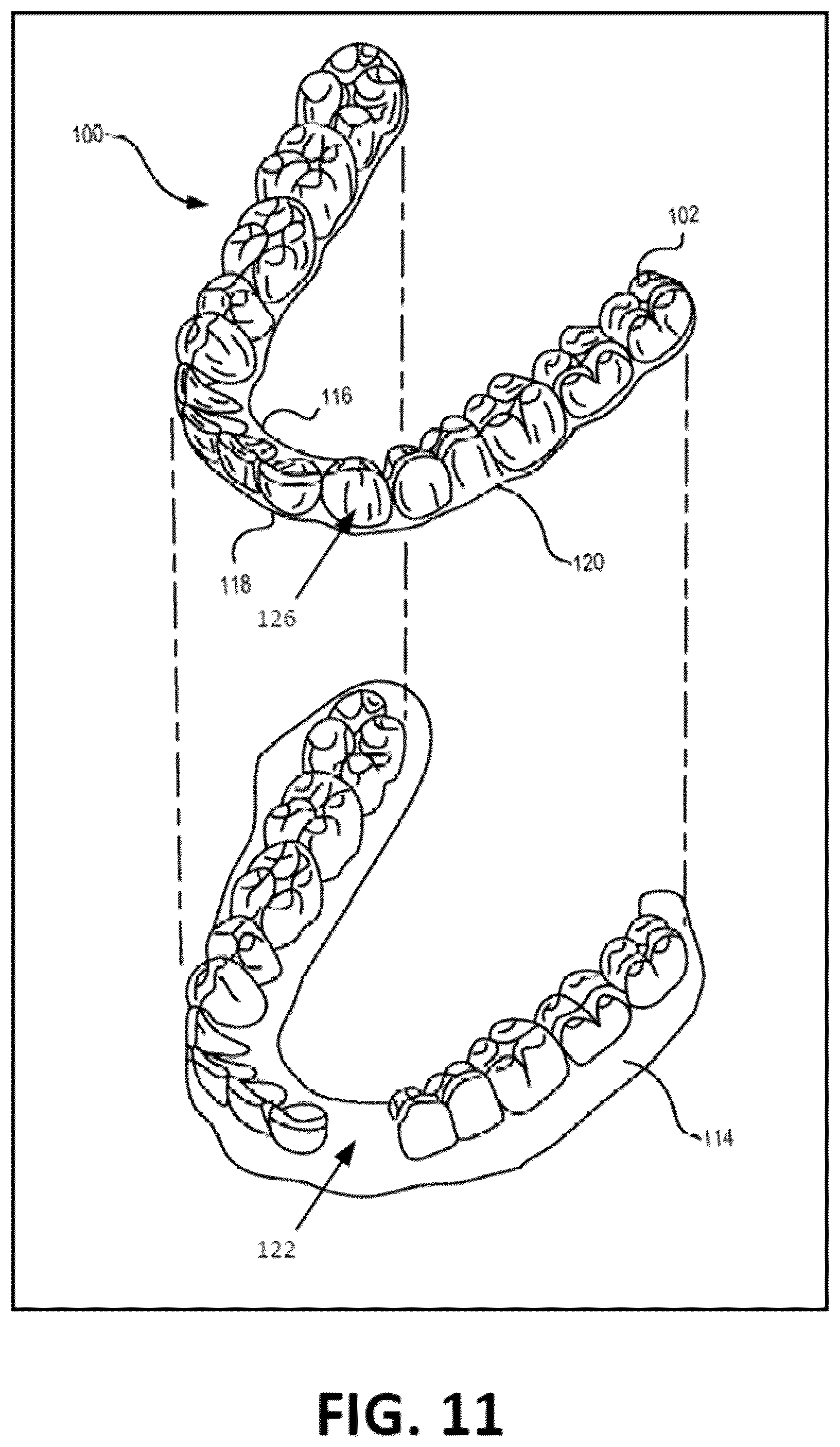 Patent US12099342 Figure 18 – Predicting shapes of at least partially un-erupted teeth