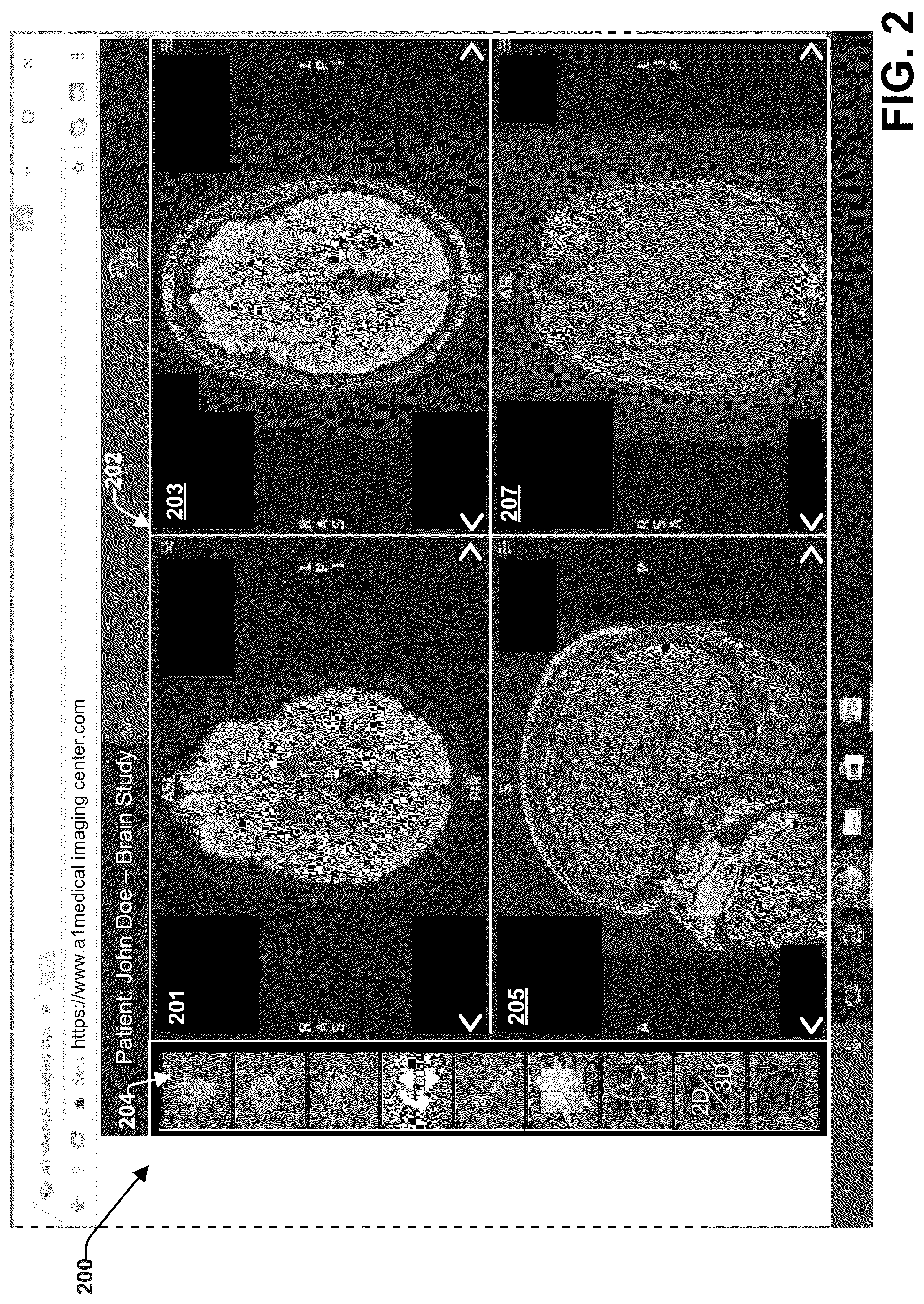 Patent US12099546 Figure 2 – Cyclic memory management for web-based medical image viewers