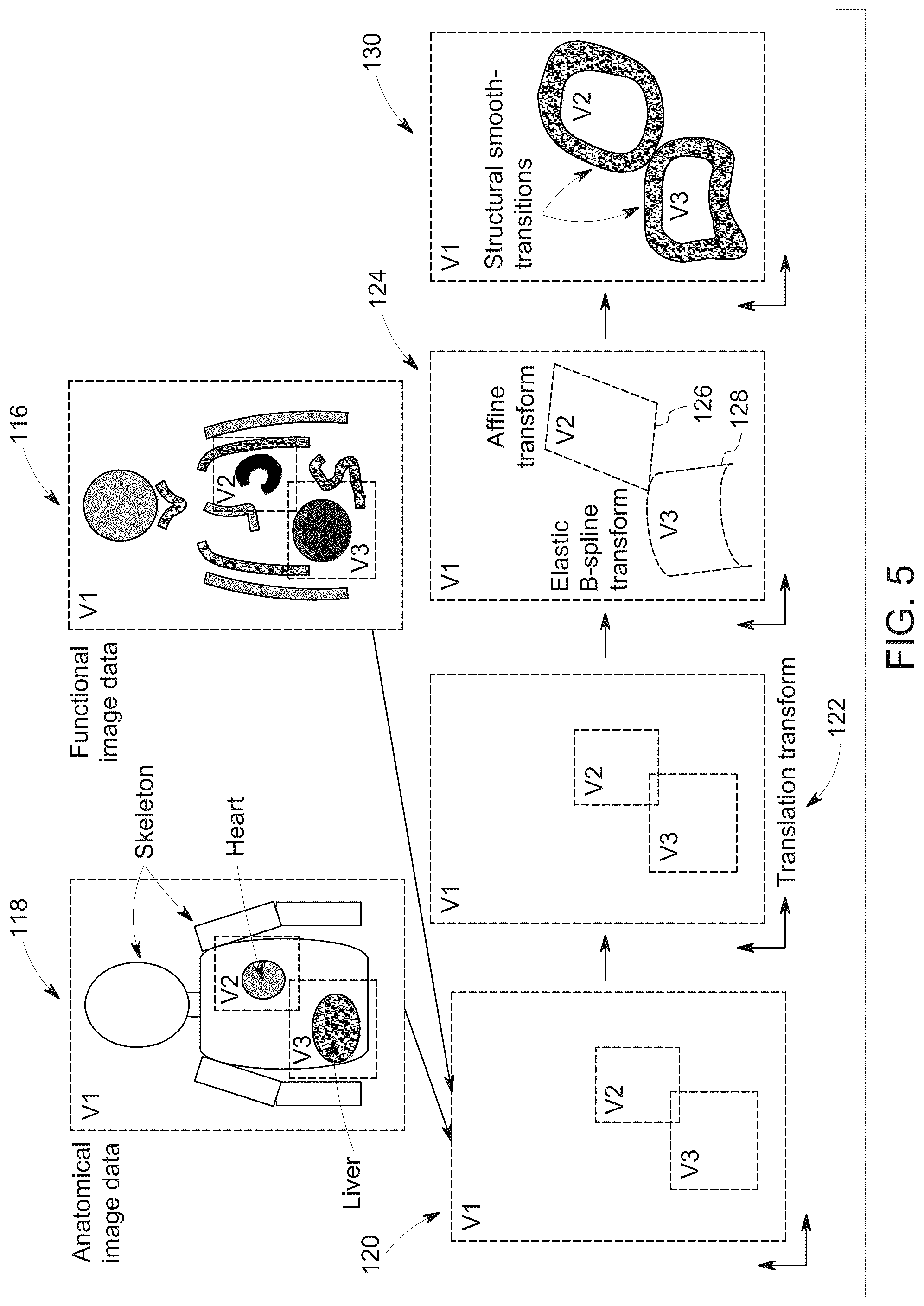 Patent US12100115 Figure 4 – System and method for cohesive multi-regional functional-anatomical medical image registration