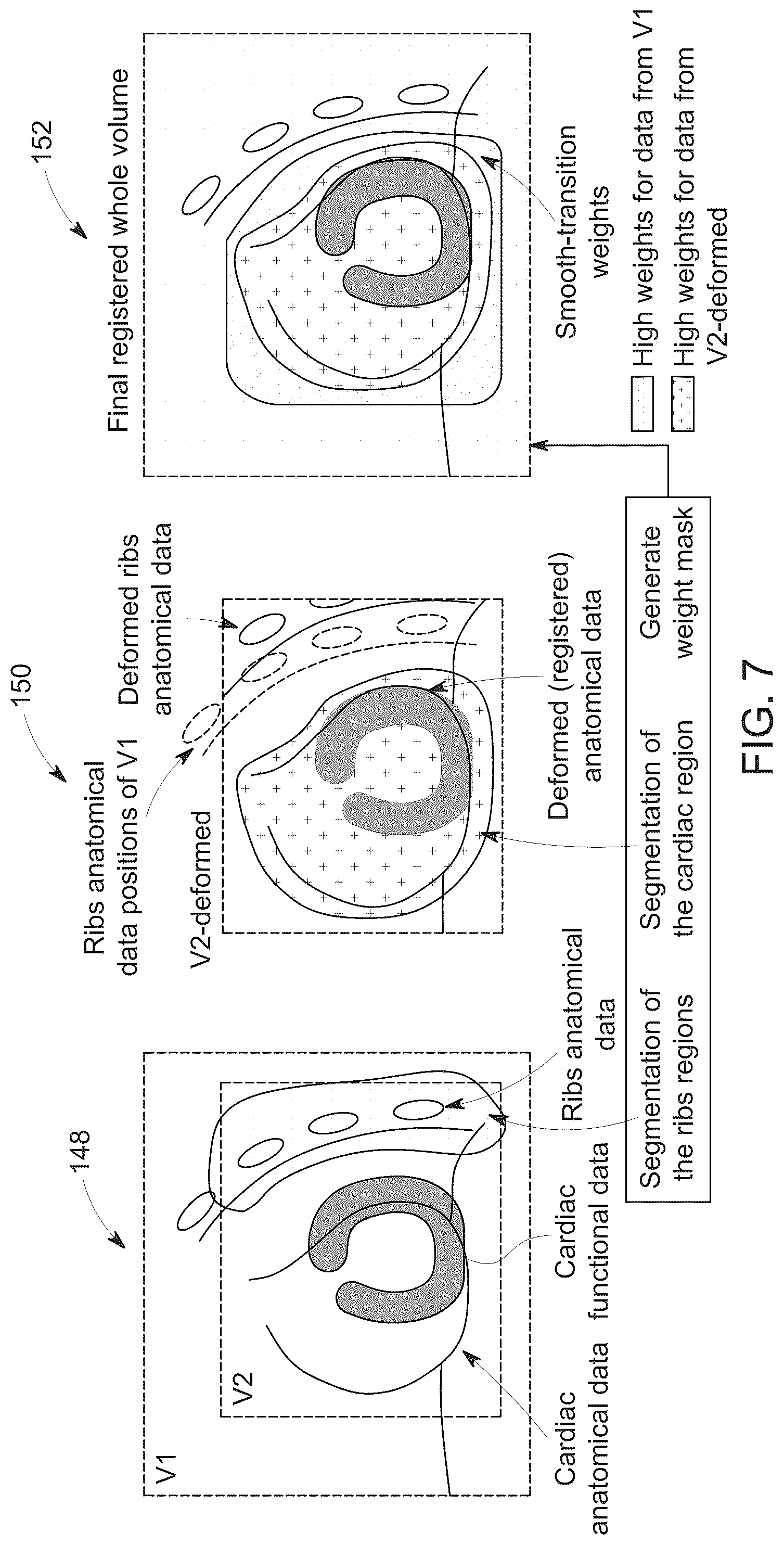 Patent US12100115 Figure 6 – System and method for cohesive multi-regional functional-anatomical medical image registration
