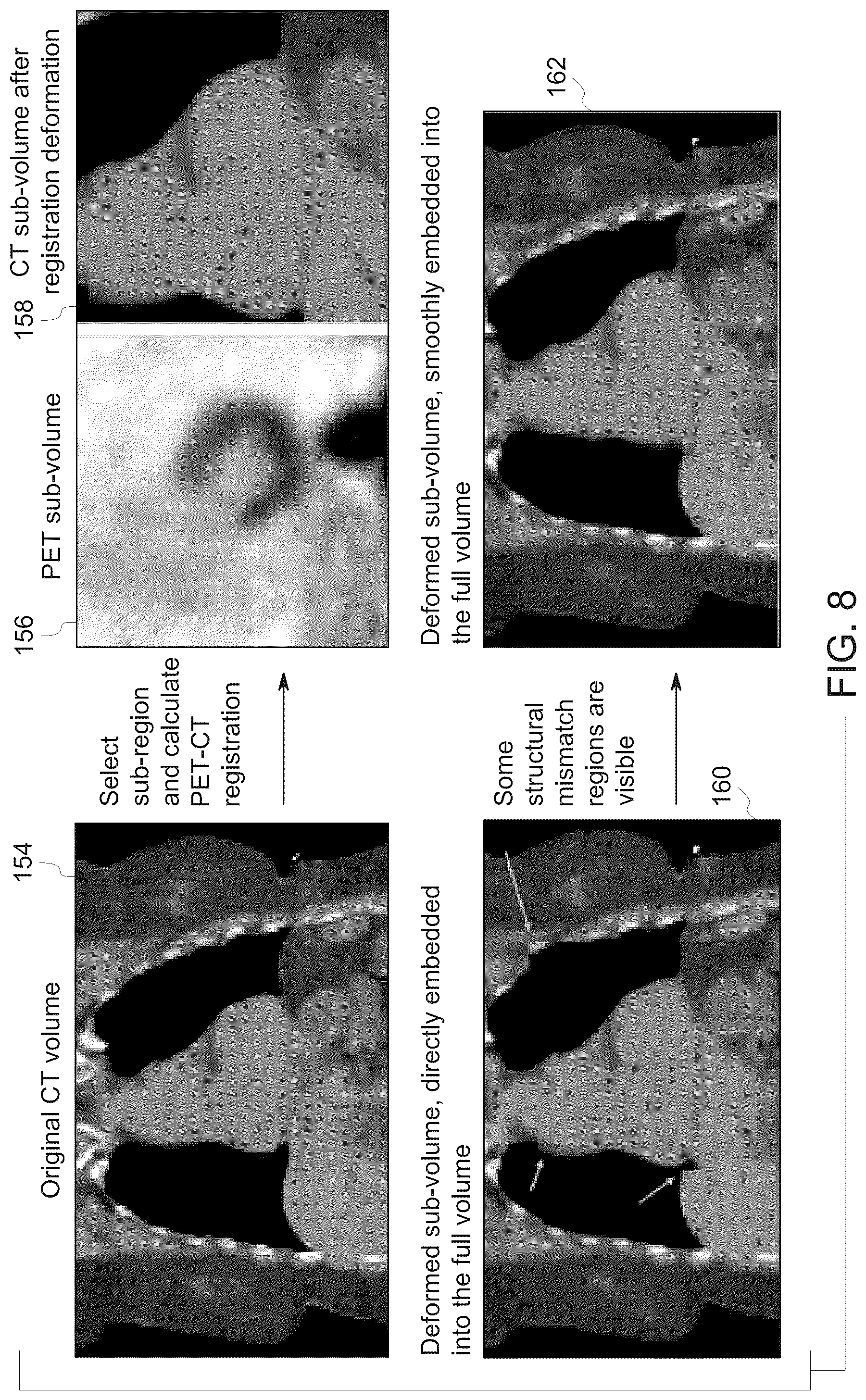 Patent US12100115 Figure 7 – System and method for cohesive multi-regional functional-anatomical medical image registration