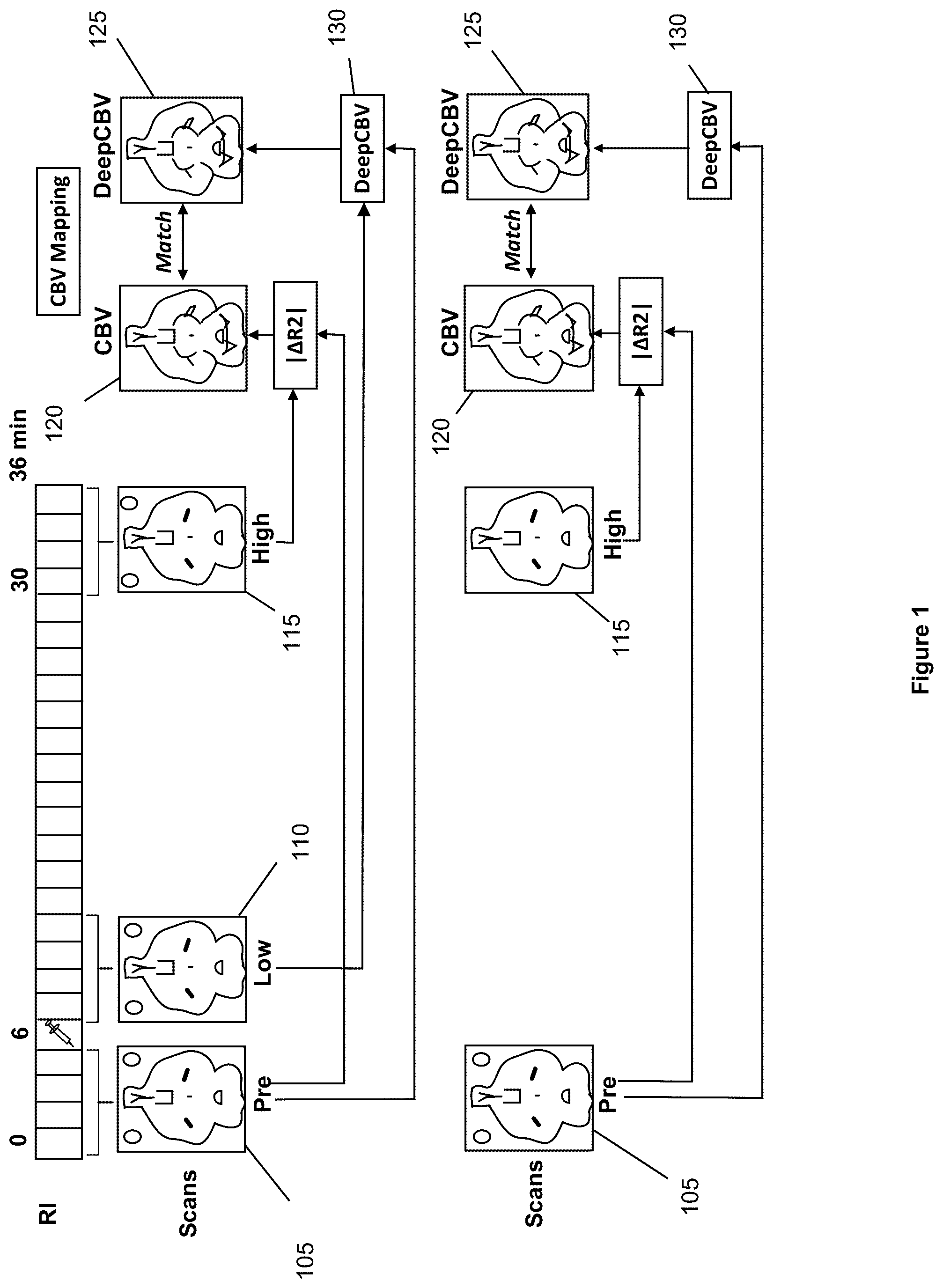 Patent US12100121 — System, method and computer-accessible medium for detecting structural disorder(s) using magnetic resonance imaging — Figure 1