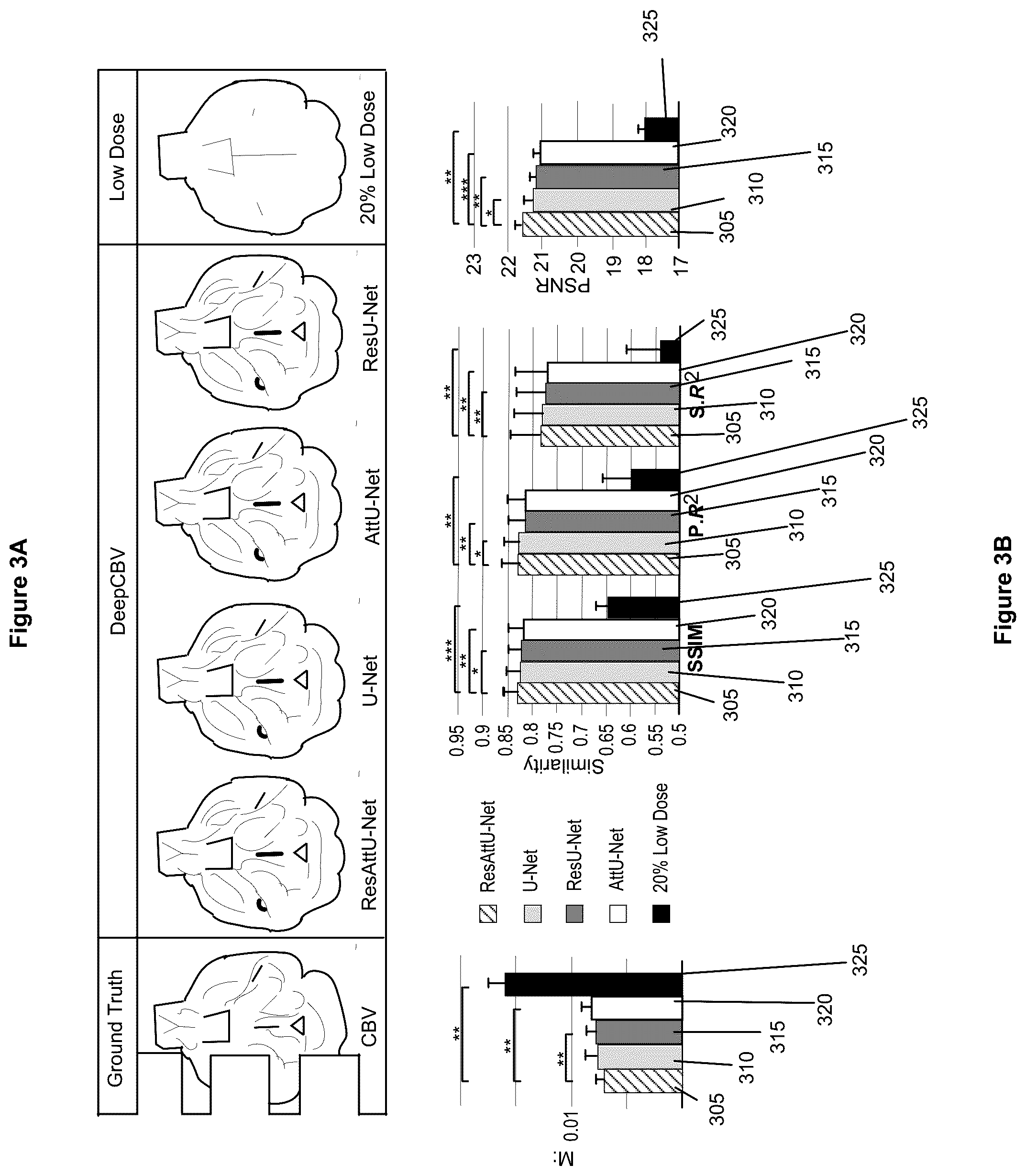 Patent US12100121 Figure 3 – System, method and computer-accessible medium for detecting structural disorder(s) using magnetic resonance imaging