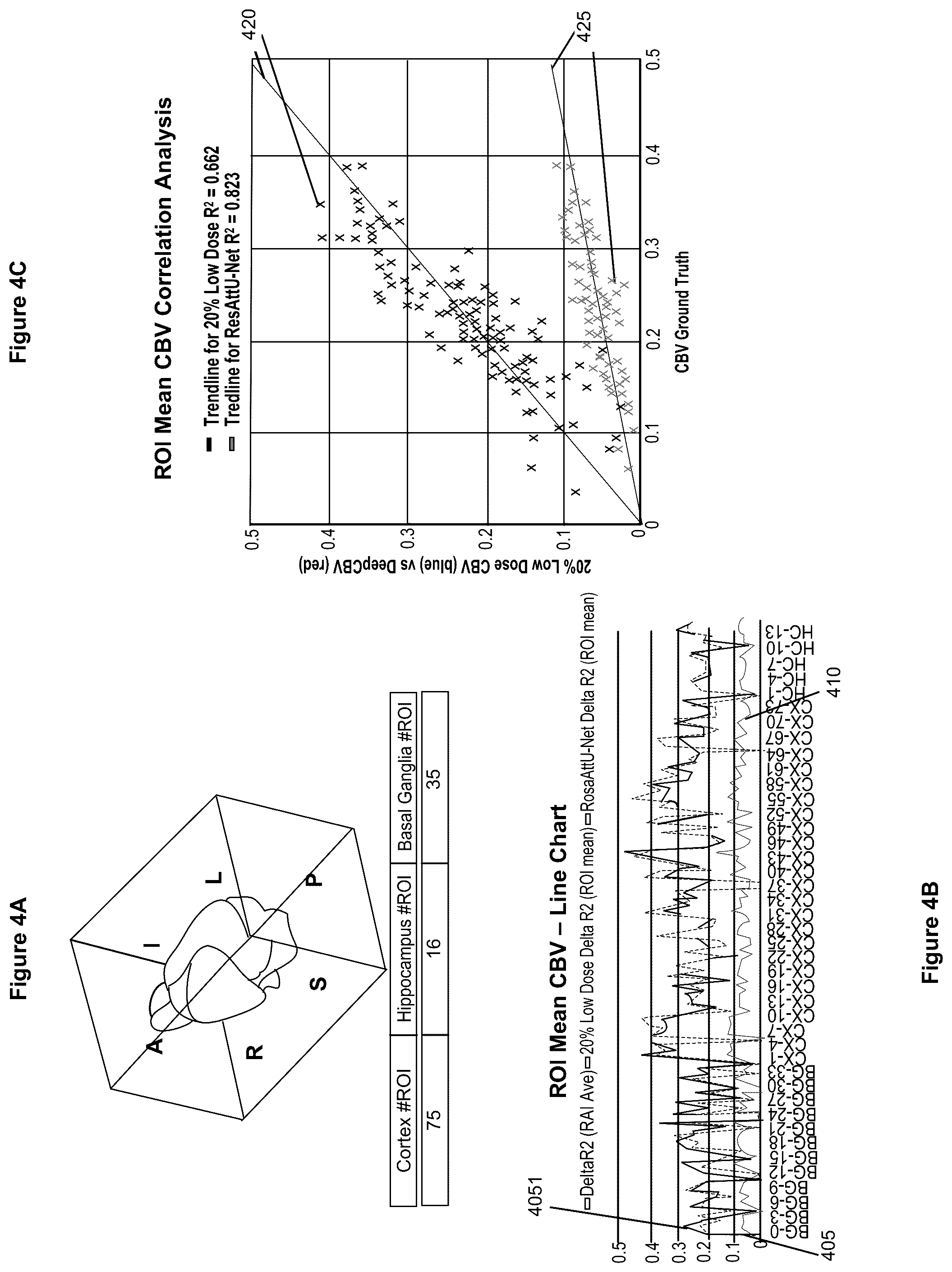 Patent US12100121 Figure 4 – System, method and computer-accessible medium for detecting structural disorder(s) using magnetic resonance imaging