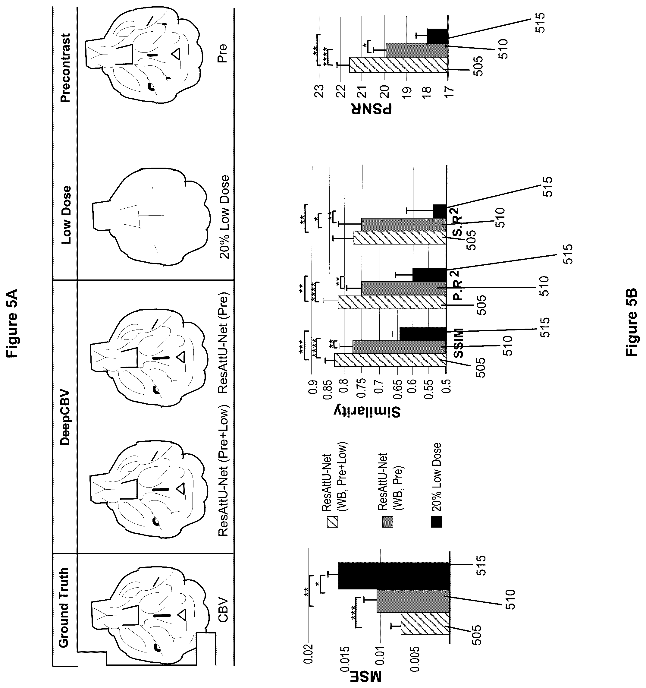 Patent US12100121 Figure 5 – System, method and computer-accessible medium for detecting structural disorder(s) using magnetic resonance imaging