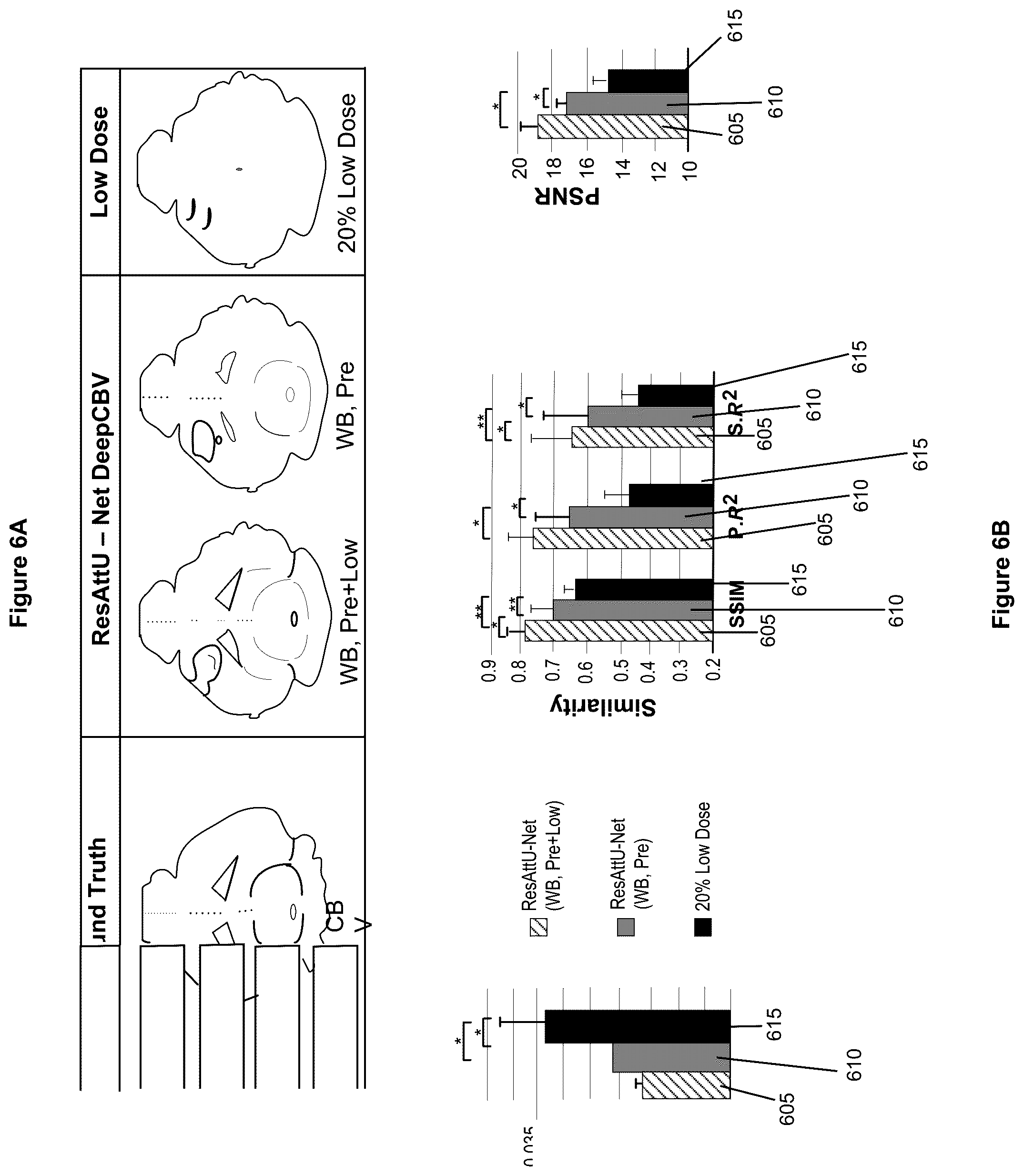 Patent US12100121 Figure 6 – System, method and computer-accessible medium for detecting structural disorder(s) using magnetic resonance imaging