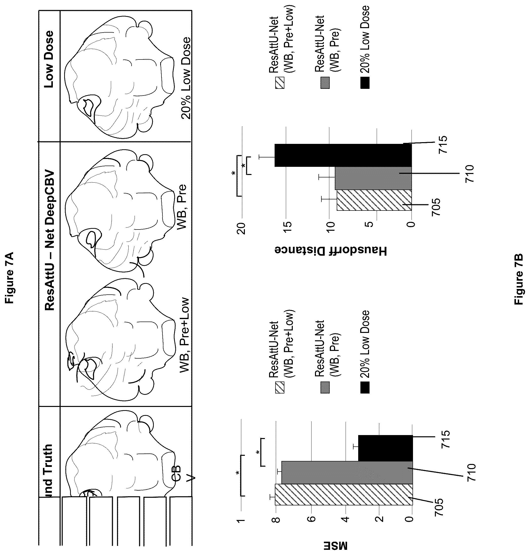 Patent US12100121 Figure 7 – System, method and computer-accessible medium for detecting structural disorder(s) using magnetic resonance imaging