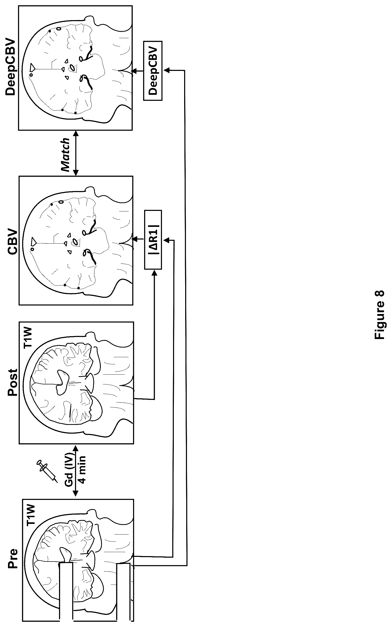 Patent US12100121 Figure 8 – System, method and computer-accessible medium for detecting structural disorder(s) using magnetic resonance imaging