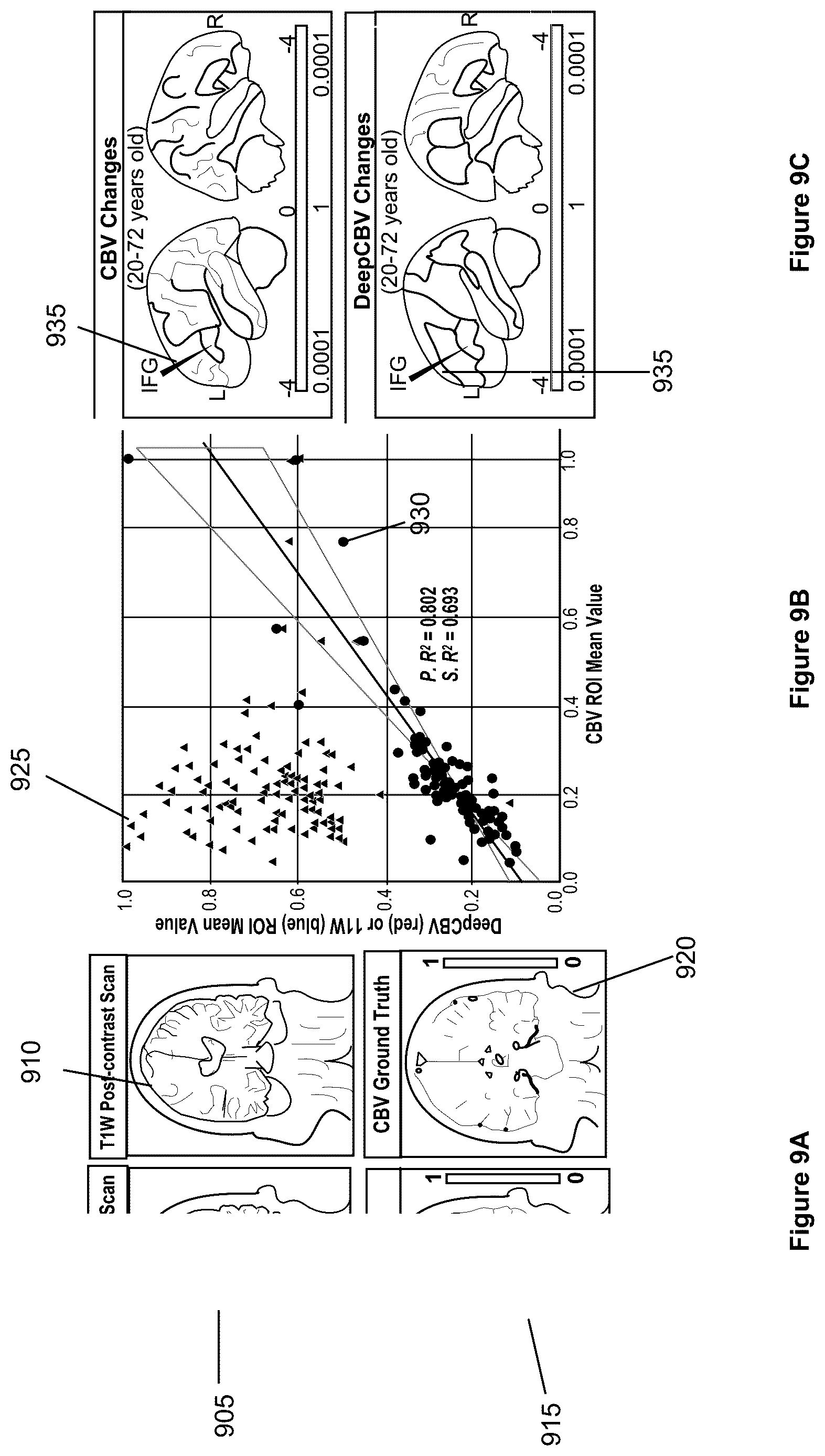 Patent US12100121 Figure 9 – System, method and computer-accessible medium for detecting structural disorder(s) using magnetic resonance imaging