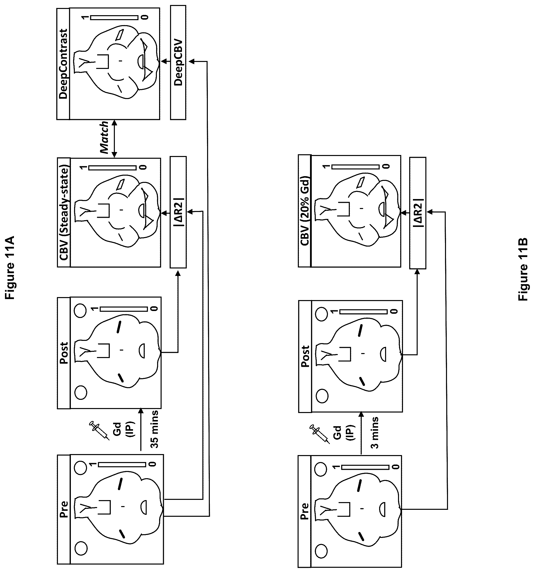 Patent US12100121 Figure 11 – System, method and computer-accessible medium for detecting structural disorder(s) using magnetic resonance imaging