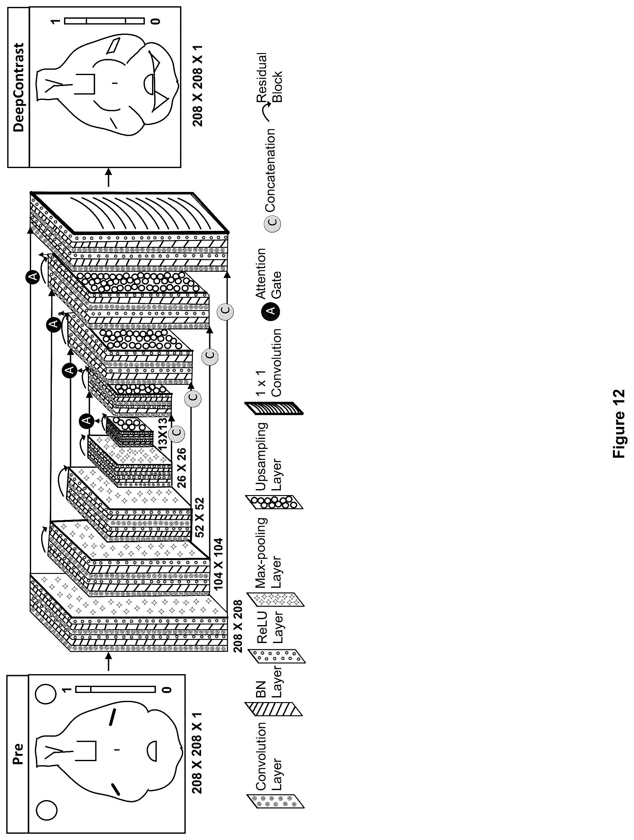 Patent US12100121 Figure 12 – System, method and computer-accessible medium for detecting structural disorder(s) using magnetic resonance imaging