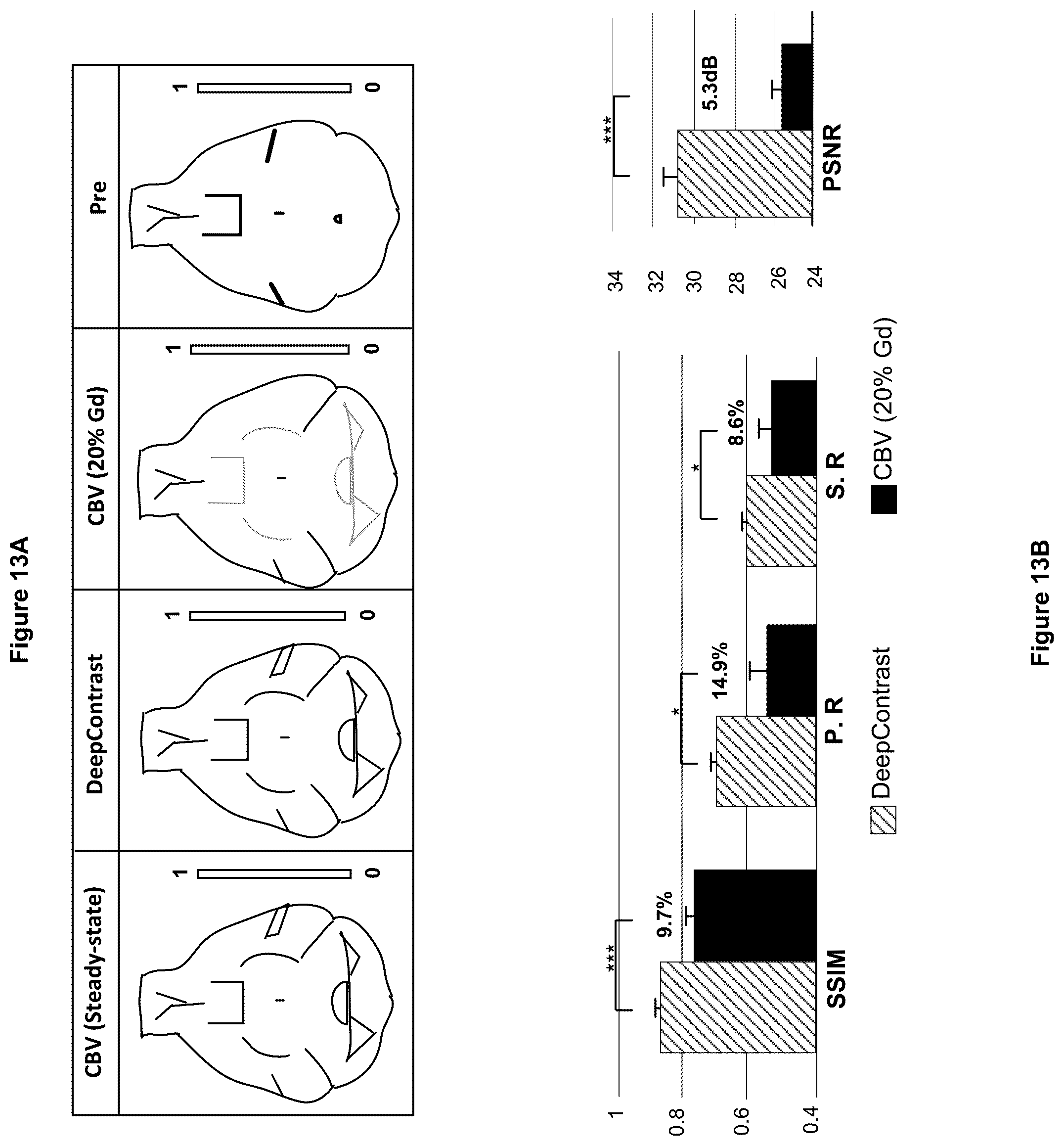 Patent US12100121 Figure 13 – System, method and computer-accessible medium for detecting structural disorder(s) using magnetic resonance imaging