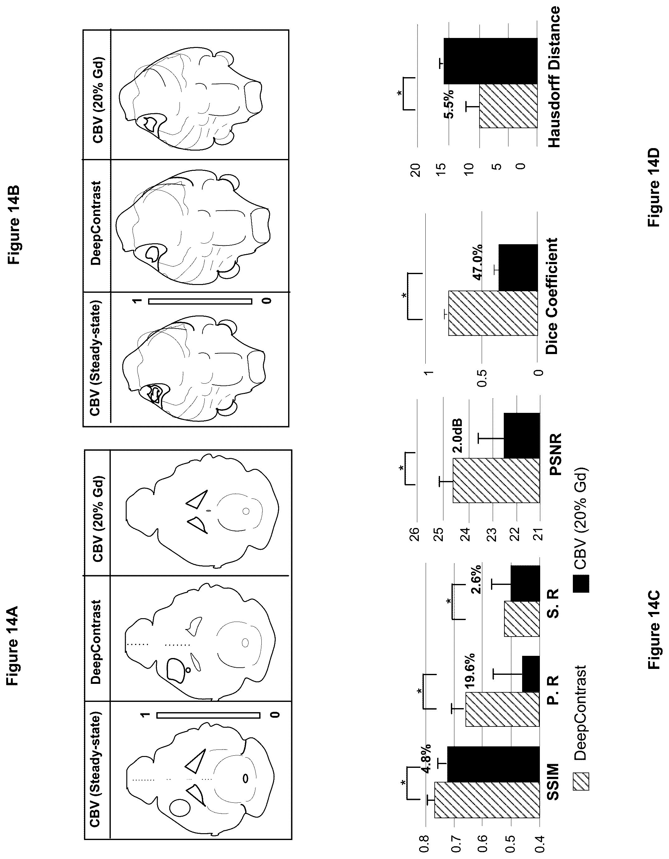 Patent US12100121 Figure 14 – System, method and computer-accessible medium for detecting structural disorder(s) using magnetic resonance imaging