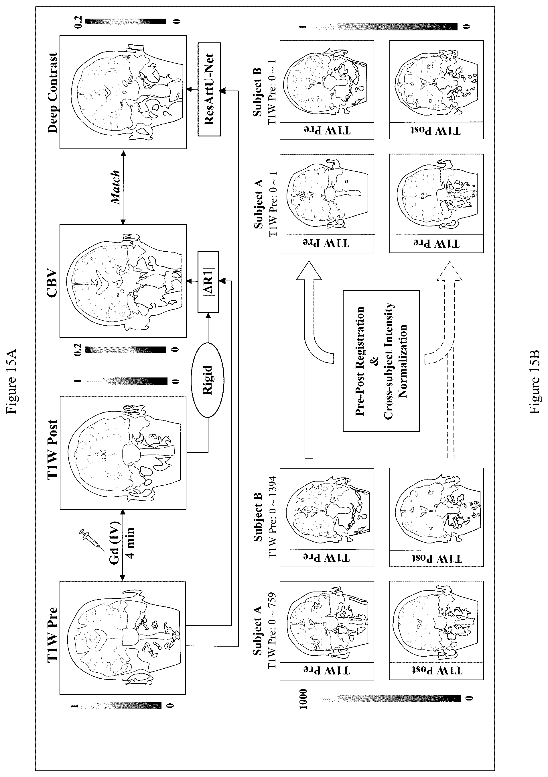 Patent US12100121 Figure 15 – System, method and computer-accessible medium for detecting structural disorder(s) using magnetic resonance imaging