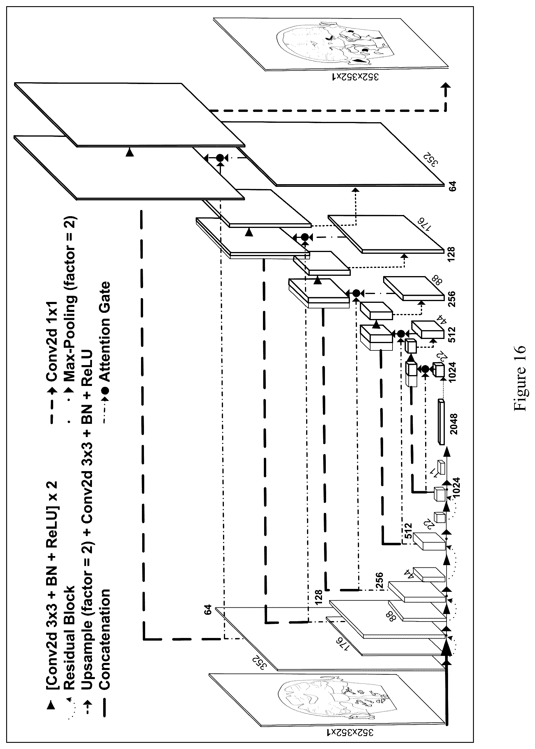 Patent US12100121 Figure 16 – System, method and computer-accessible medium for detecting structural disorder(s) using magnetic resonance imaging