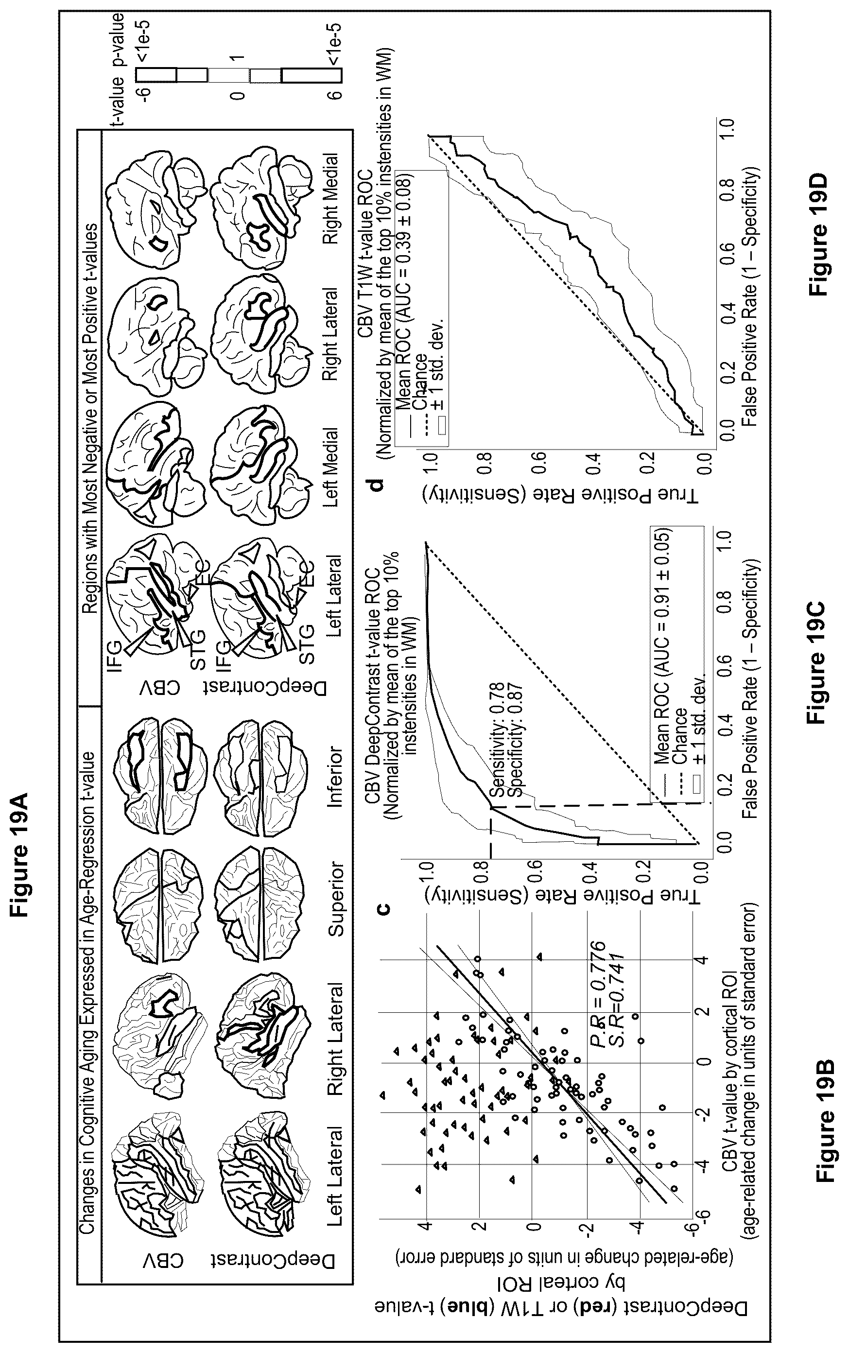 Patent US12100121 Figure 19 – System, method and computer-accessible medium for detecting structural disorder(s) using magnetic resonance imaging
